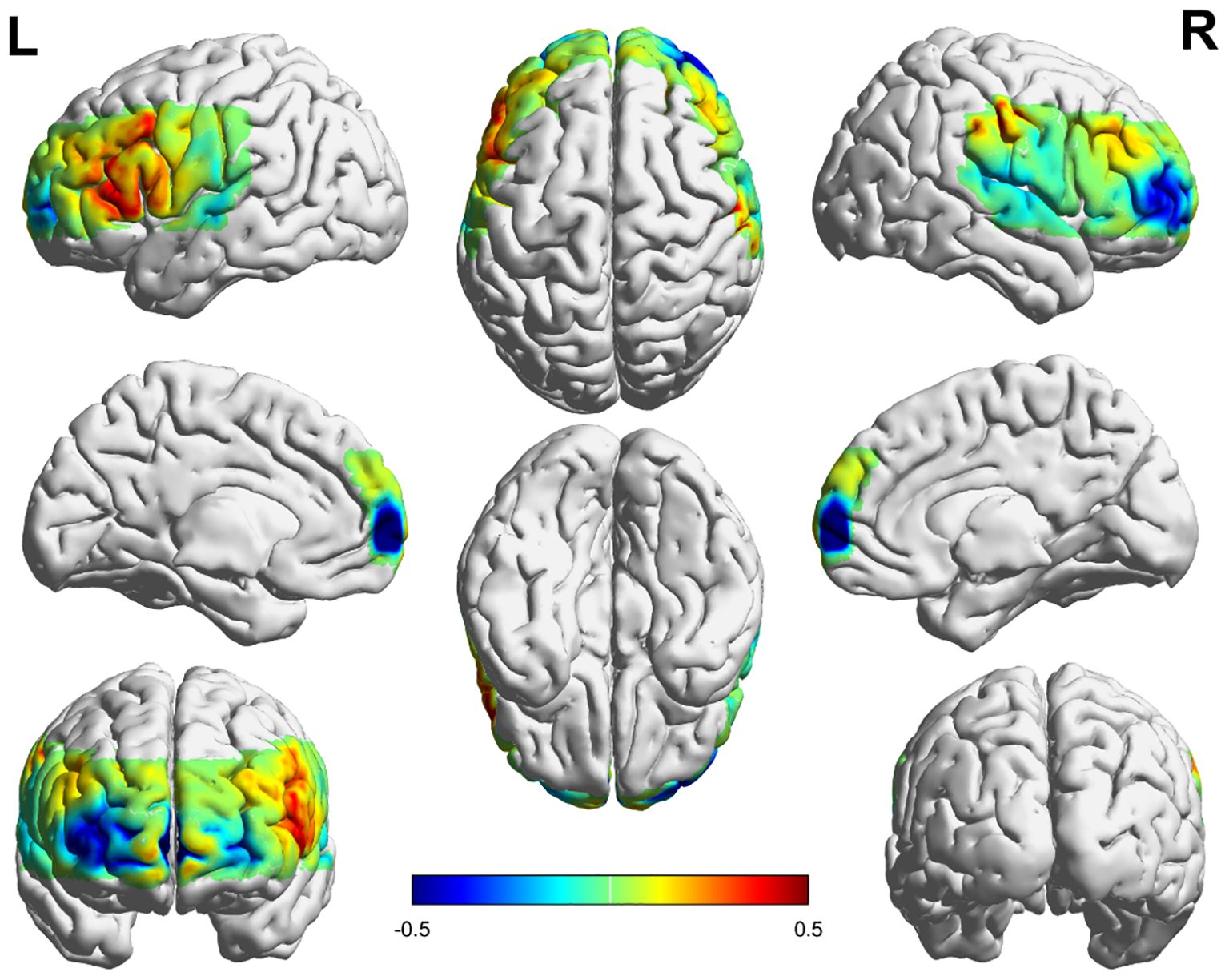 Brain imaging illustrations showing various views of the left and right hemispheres with color-coded areas of activity. The scale at the bottom ranges from negative zero point five to positive zero point five, indicating intensity levels from blue to red. The central top image shows a top view of both hemispheres.