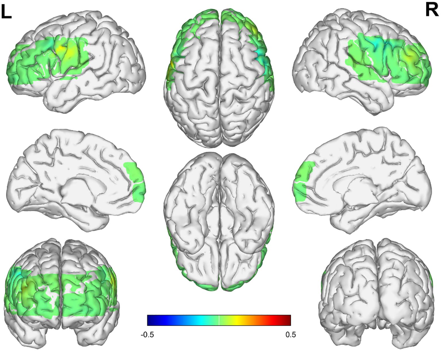Several views of a 3D brain model showing activity distribution. Green, yellow, and blue shades indicate varying levels of activation. Different brain angles are illustrated, with a color bar ranging from -0.5 in blue to 0.5 in red at the bottom.