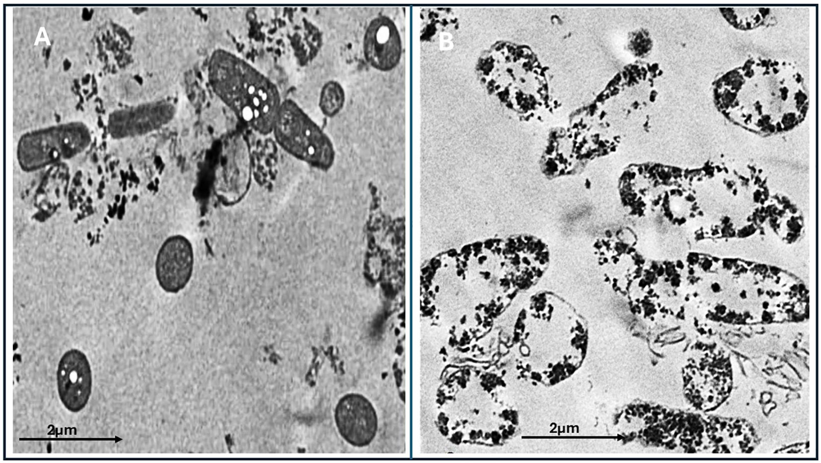 Electron micrograph showing two panels labeled A and B. Panel A depicts rod-shaped bacteria with a textured background and intracellular details, while panel B shows more irregularly shaped forms, also with intracellular textures. Both images include a scale bar of two micrometers.