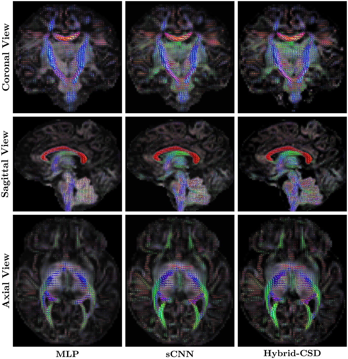 Fiber orientation distribution of neonatal brain in coronal, sagittal, and axial views, comparing three methods: MLP, sCNN, and Hybrid-CSD.