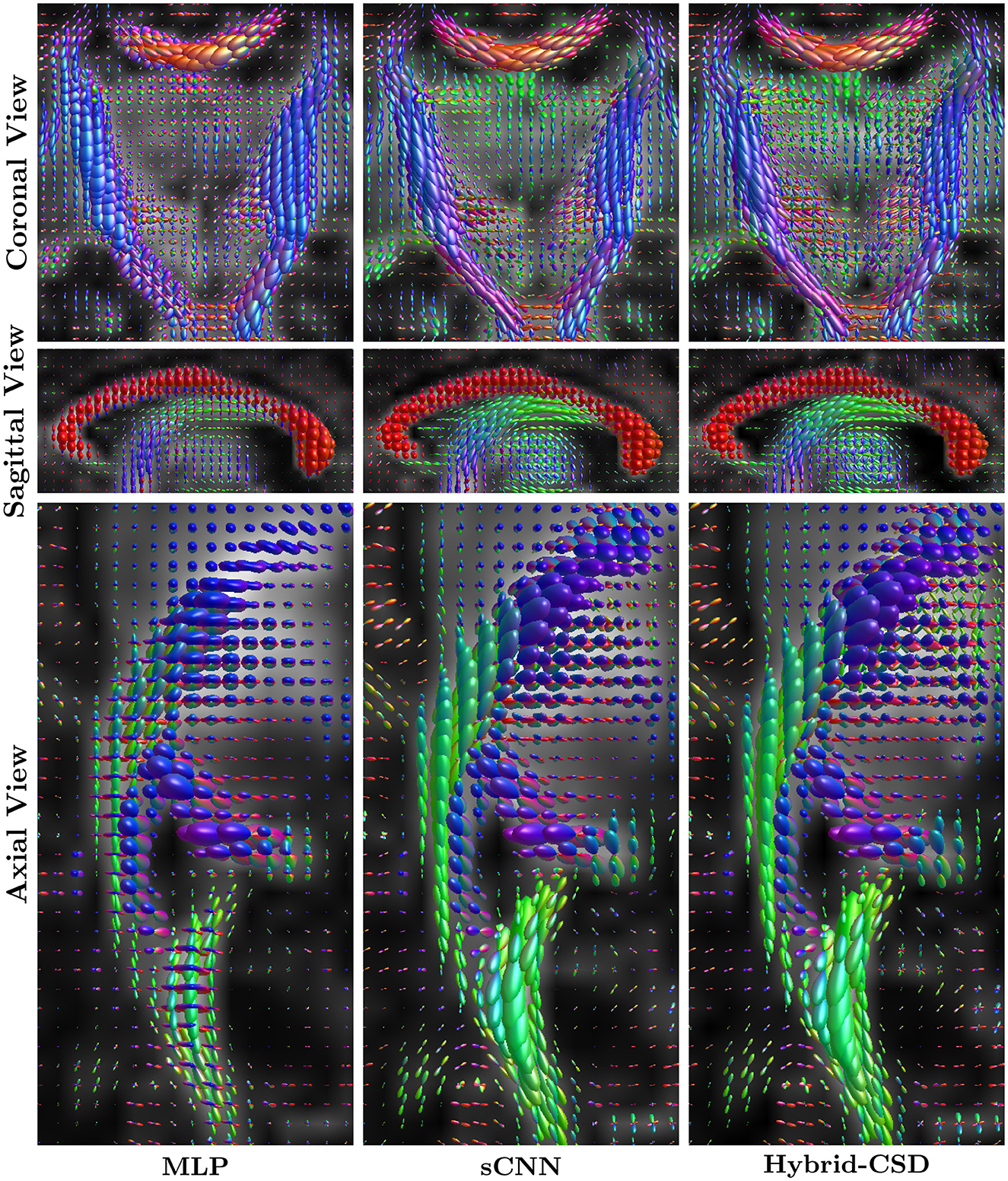 Three rows of Zomed in of Fiber orientation distribution of neonatal brain in coronal, sagittal, and axial views, comparing three methods: MLP, sCNN, and Hybrid-CSD.
