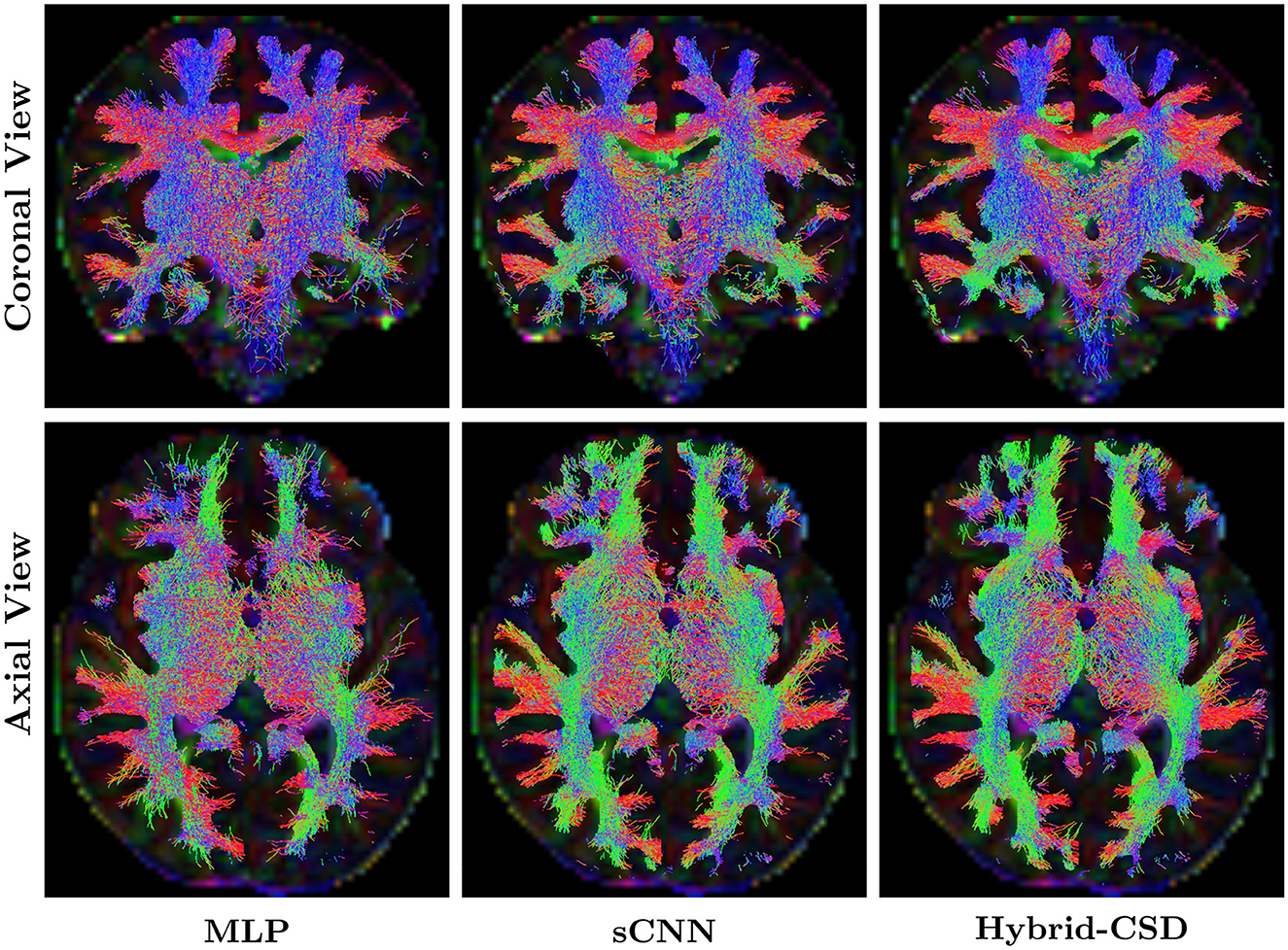 Coronal and axial brain scans show colorful fiber tractography in three columns labeled MLP, sCNN, and Hybrid-CSD. Fibers are depicted in shades of red, green, and blue, indicating different pathways and orientations. The coronal views are on the top row, while axial views are on the bottom. The colors and density of the tracts vary across the methods.
