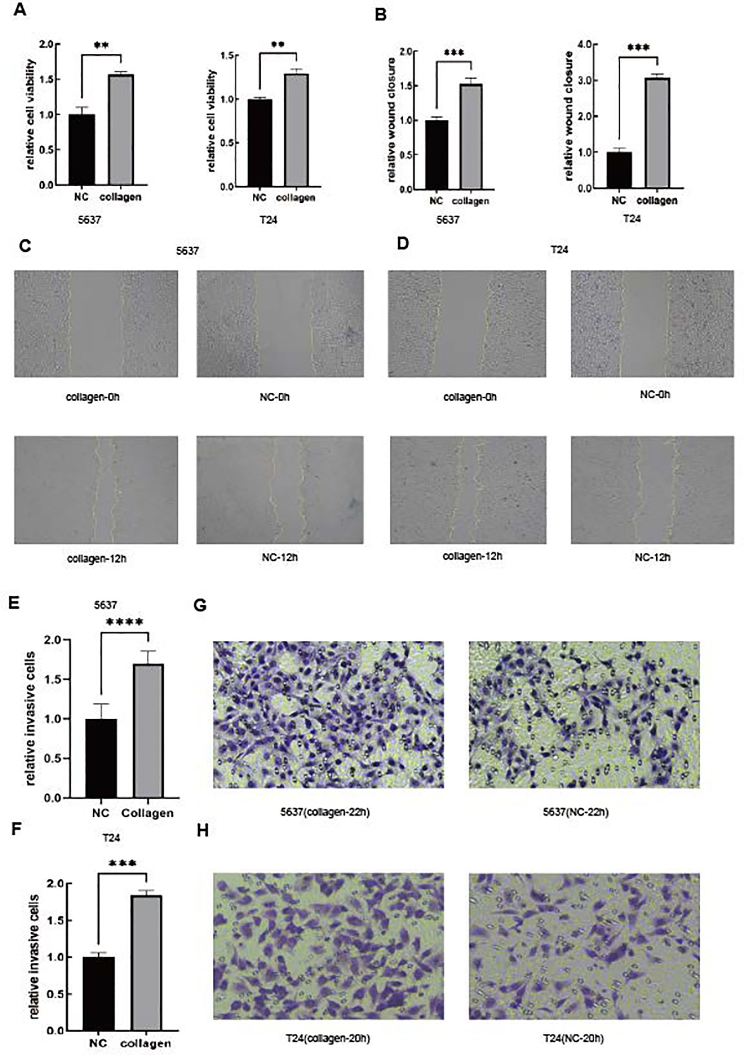 Graphs and images display the effects of collagen on cell viability, wound closure, and cell invasion. Panels A and B show bar graphs with significant differences in cell viability and wound closure for 5637 and T24 cells. Panels C and D present microscopy images of cell migration at 0 and 12 hours. Panels E and F include bar graphs highlighting increased invasive cells in collagen conditions. Panels G and H show stained cell invasion images for 5637 and T24 under collagen conditions at 12 and 20 hours.