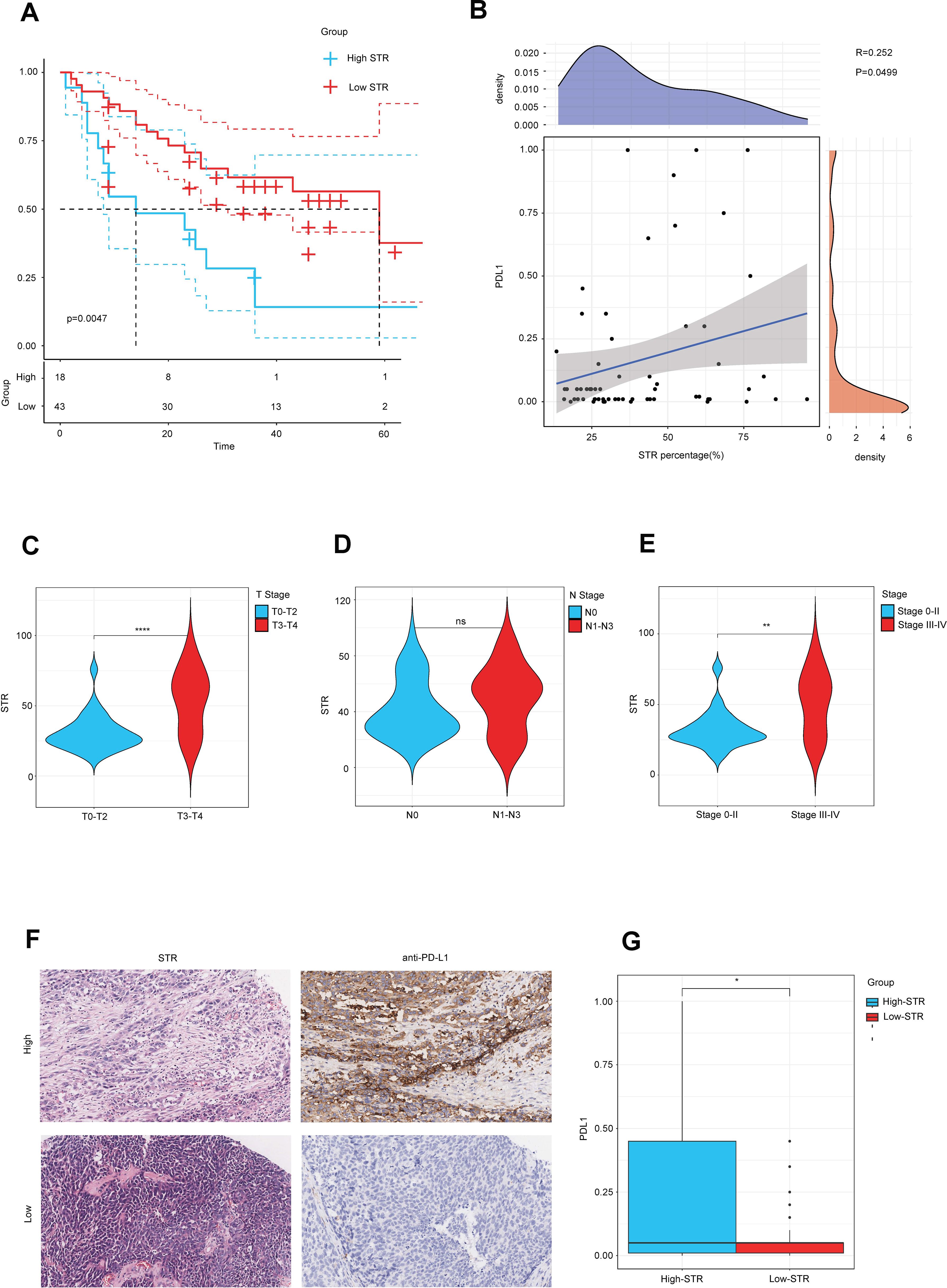 Panel A shows a Kaplan-Meier survival curve comparing high and low STR groups. Panel B presents a scatter plot with STR percentage versus PD-L1, accompanied by density plots. Panels C, D, and E are violin plots showing STR across different T, N, and overall cancer stages. Panel F contains histological images comparing high and low STR with anti-PD-L1 staining. Panel G is a bar graph showing PD-L1 levels in high and low STR groups.