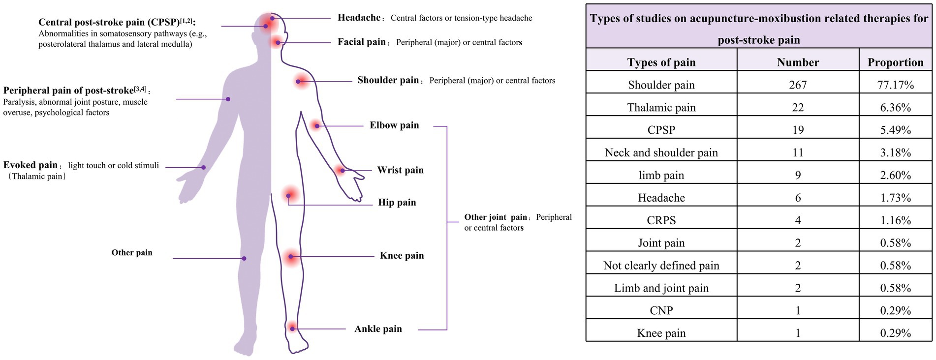 Diagram illustrating types of post-stroke pain on a human silhouette, highlighting locations such as head, shoulder, elbow, wrist, hip, knee, and ankle. Associated factors include central and peripheral causes. A table on the right lists study proportions of acupuncture-related therapies for post-stroke pain, showing shoulder pain as most studied at 77.17%, followed by thalamic pain at 6.36%, and other pain types with lower proportions.