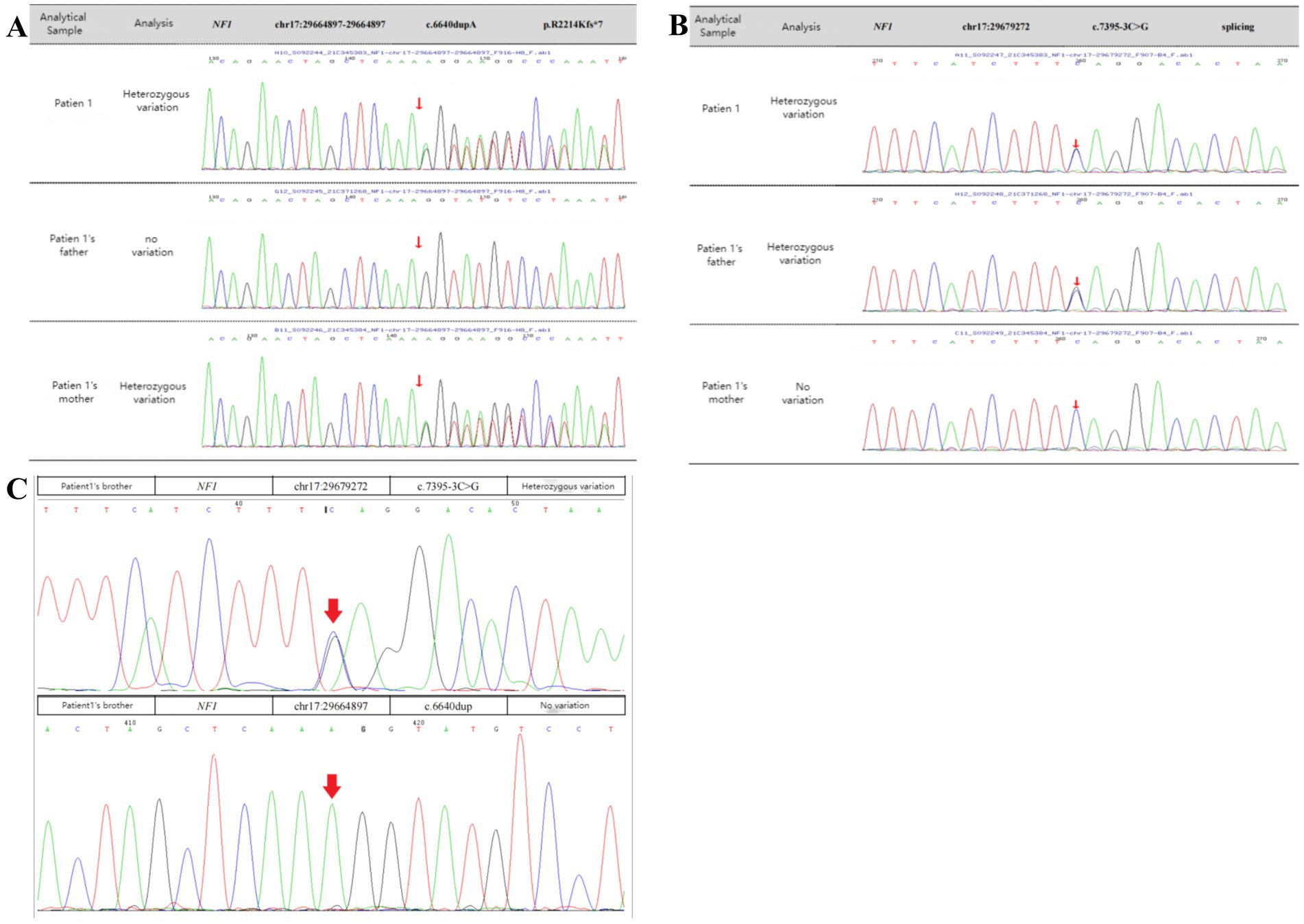 Genetic analysis charts display chromatogram results for NF1 gene variations. Panel A shows Patient 1 and parents; heterozygous variations appear in Patient 1 and mother, none in father. Panel B reveals heterozygous and no variations for splicing in Patient 1 and parents. Panel C presents Patient 1's brother with heterozygous variation at chr17:29679272 and no variation at chr17:29664897. Arrows indicate specific variations.