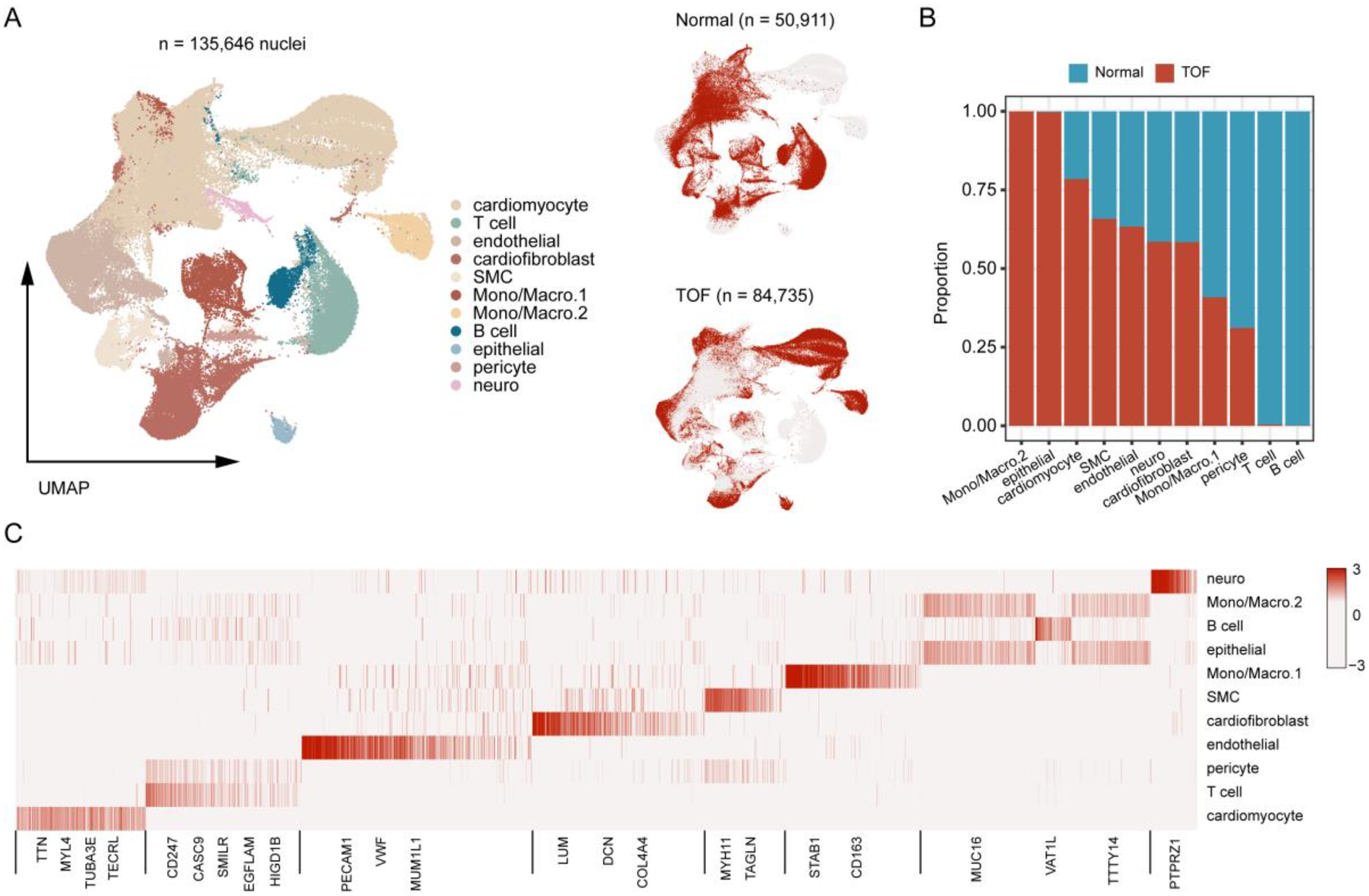 A set of three panels illustrating different aspects of cellular analysis. Panel A shows a UMAP plot with 135,646 nuclei, categorized into cell types such as cardiomyocytes and T cells. Panel B presents a bar chart comparing the proportion of cell types between normal and TOF tissues. Panel C is a heatmap illustrating gene expression across various cell types.