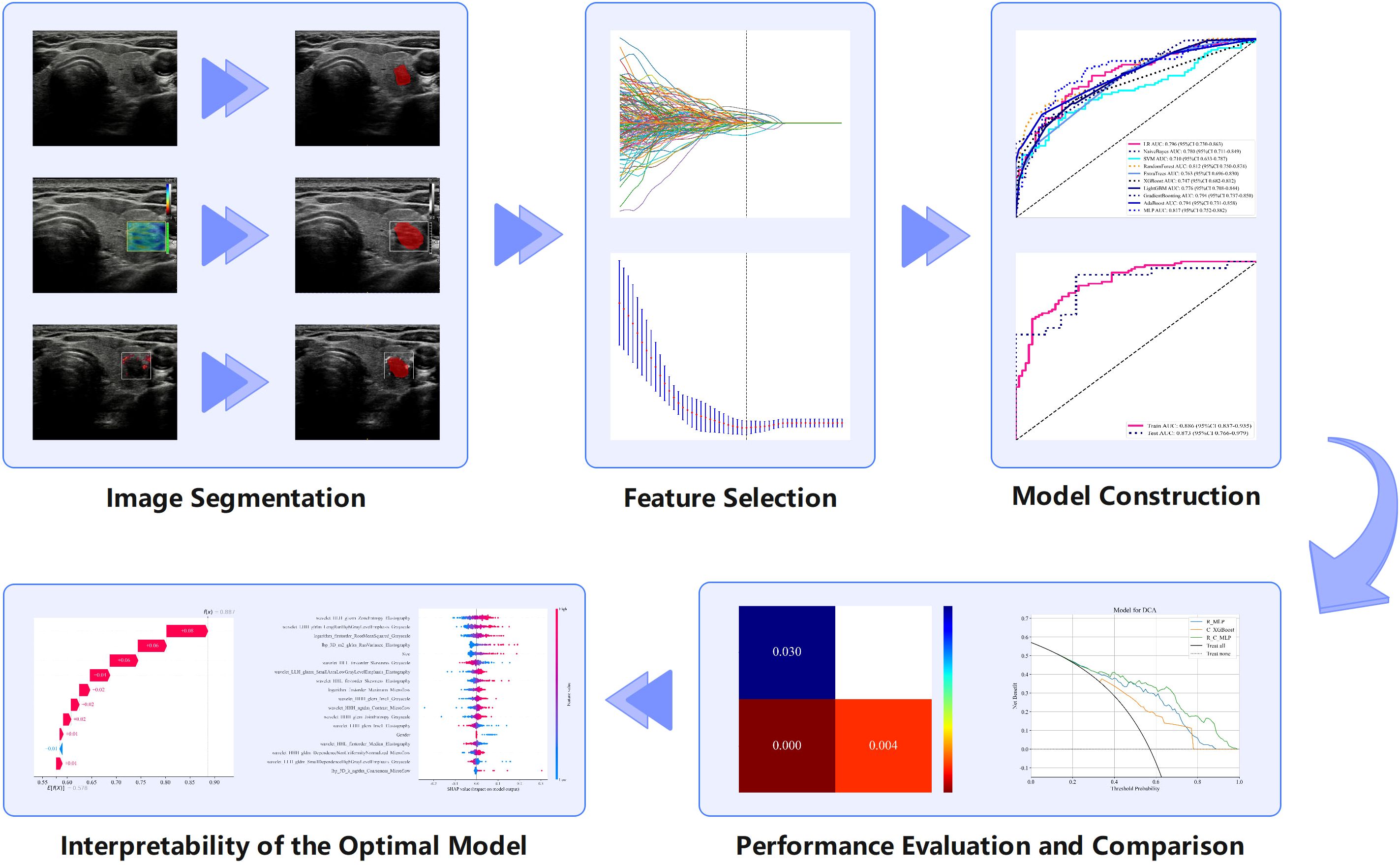 Flowchart illustrating a machine learning pipeline for medical imaging. It includes five stages: Image Segmentation with ultrasound images and highlighted areas, Feature Selection using graphs with overlapping lines, Model Construction with performance curves, Interpretability of the Optimal Model shown through bar graphs and plots, and Performance Evaluation and Comparison featuring heatmaps and performance graphs. Arrows between stages indicate process flow.