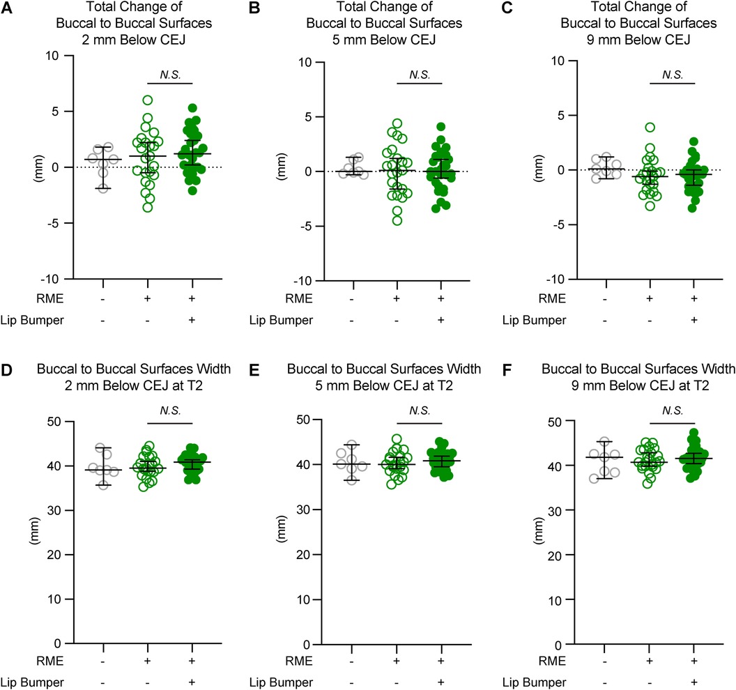 Six scatter plots displaying changes in buccal surface transverse measurements at different vertical levels relative to cementoenamel junction at first premolar with and without RME and lip bumper. Images A to C depicts total changes while images D to F show difference at T2.