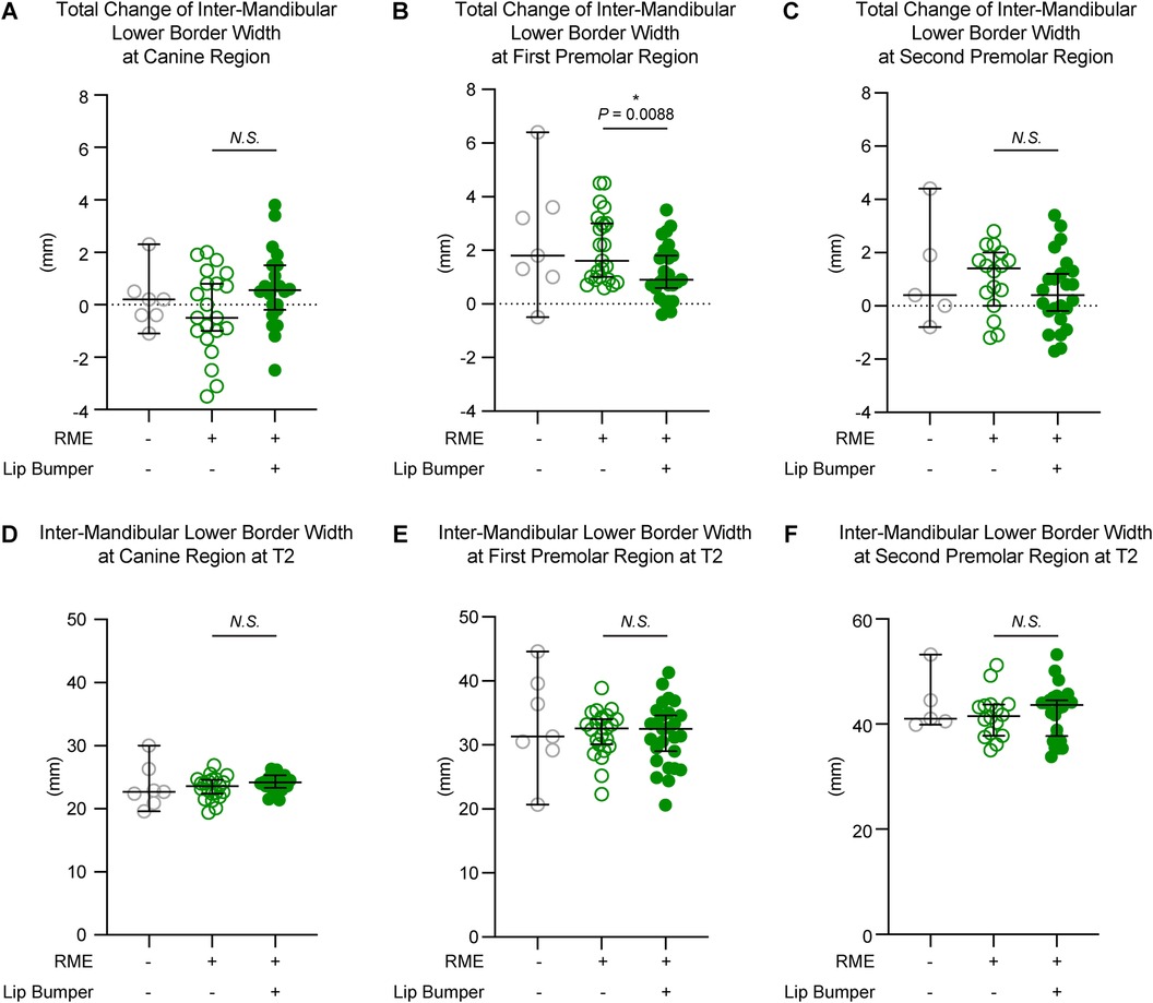 Scatter plots displaying changes in inter-mandibular lower border width at different dental region, comparing RME and lip bumper treatments. Images A to C depict total changes while images D to F show difference at T2.