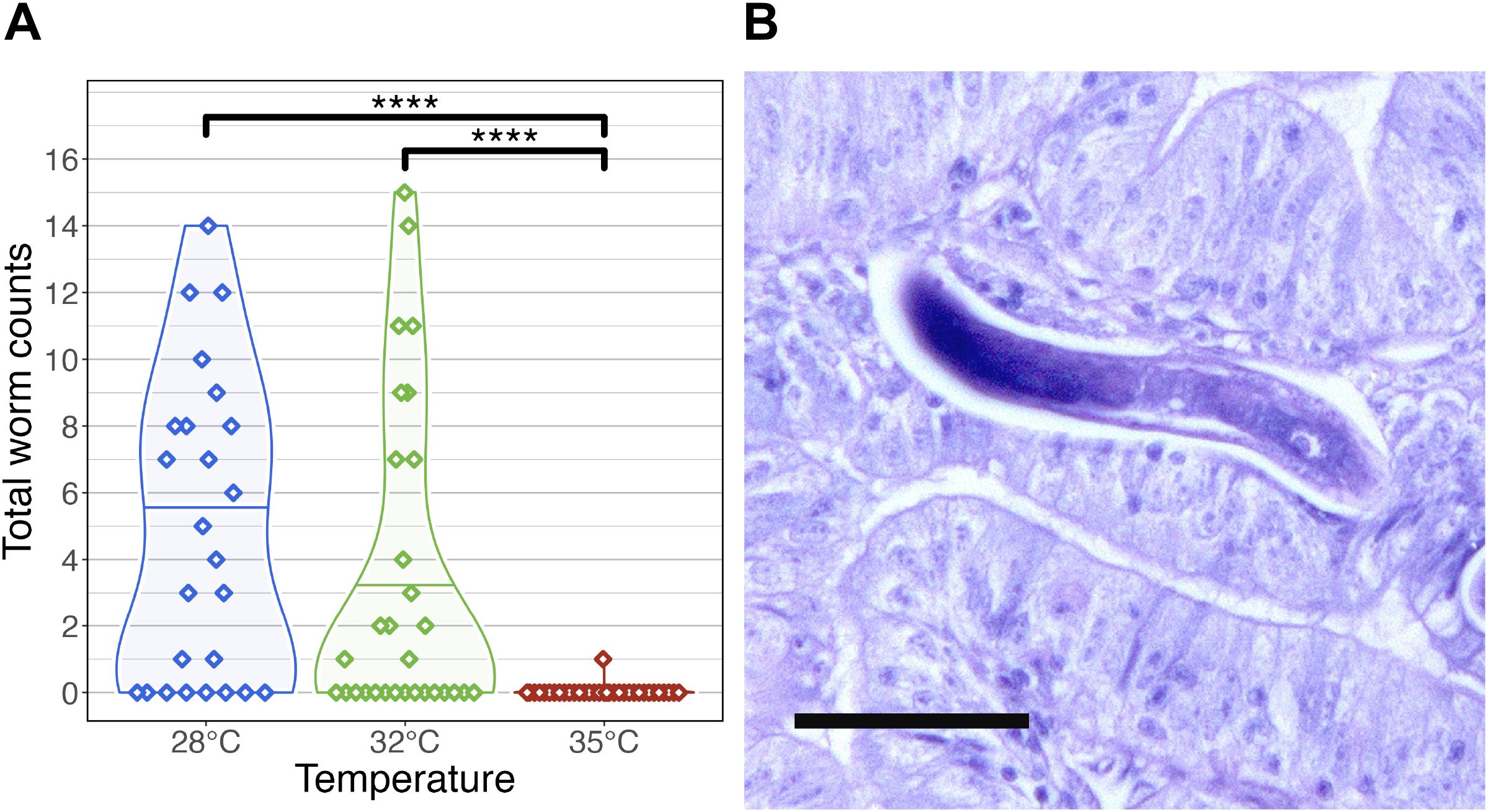 Panel A shows a violin plot depicting total worm counts at three temperatures: 28°C, 32°C, and 35°C. The counts decrease significantly as temperature increases, with statistical significance indicated by asterisks. Panel B displays a microscopic image of a worm within tissue, stained for detail.