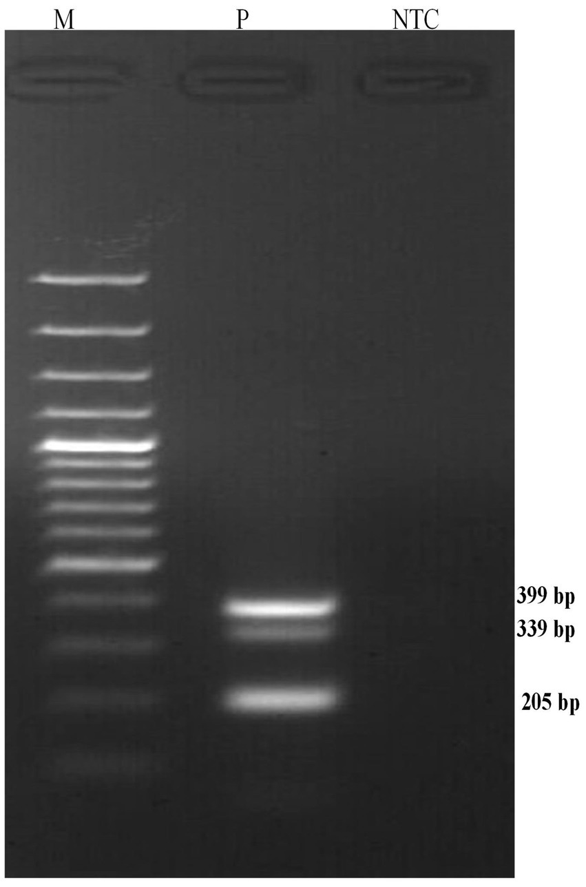 Gel electrophoresis image showing three lanes labeled M, P, and NTC. Lane M contains a DNA ladder with several visible bands. Lane P shows two prominent bands at 399 base pairs and 339 base pairs. Lane NTC shows no visible bands.