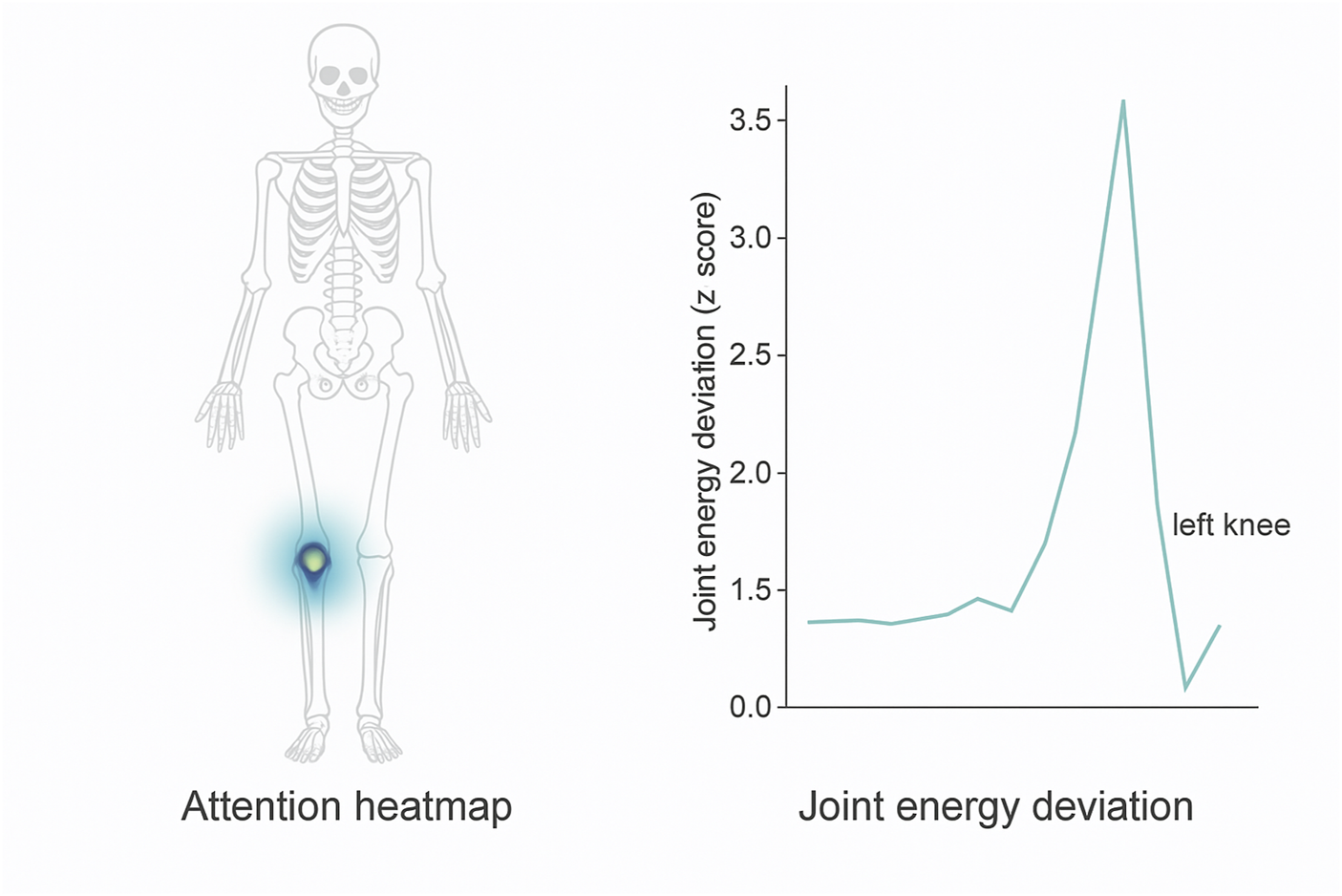Skeleton diagram with an attention heatmap highlighting the left knee, indicating focused energy at that joint. Adjacent graph shows a spike in joint energy deviation (Z score) at the left knee.