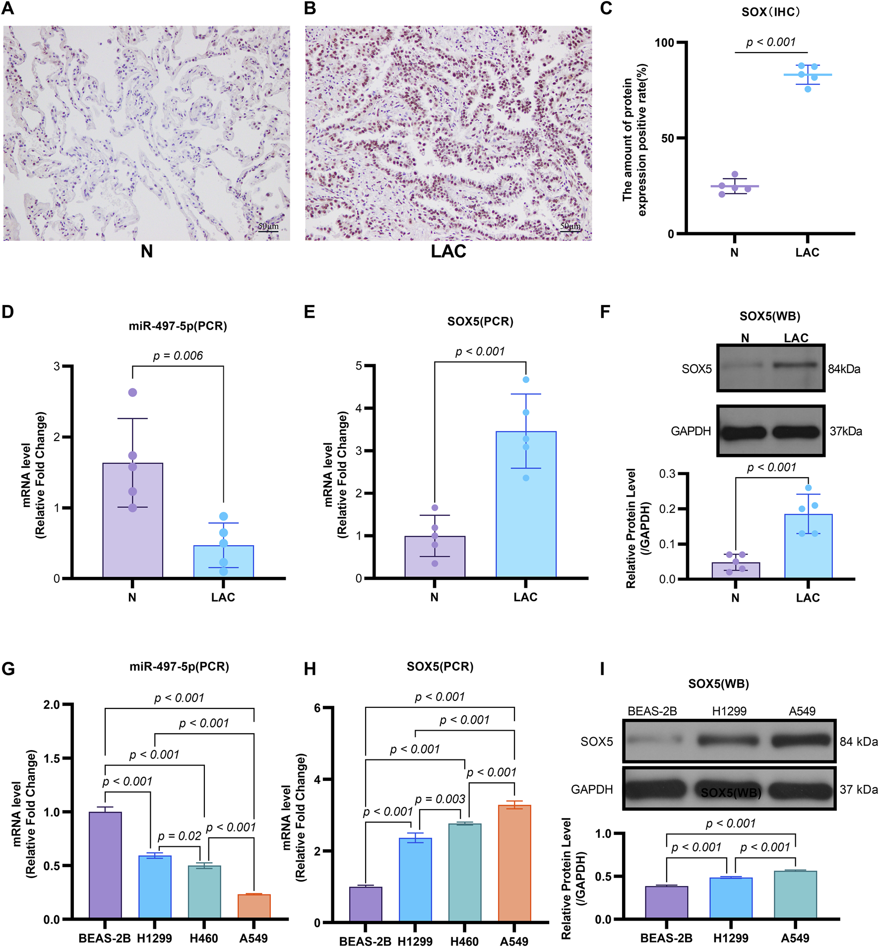 Panels show analysis of SOX expression and miR-497-5p levels. (A, B) Images of normal (N) and lung adenocarcinoma (LAC) tissue stained for SOX. (C) Graph comparing SOX protein expression in N and LAC tissues. (D, E) Bar graphs showing miR-497-5p and SOX mRNA levels in N and LAC tissues. (F) Western blot and bar graph for SOX5 protein levels in N and LAC. (G, H) Bar graphs of miR-497-5p and SOX mRNA levels across cell lines. (I) Western blot and bar graph showing SOX5 protein levels in different cell lines. Statistical significance is indicated.