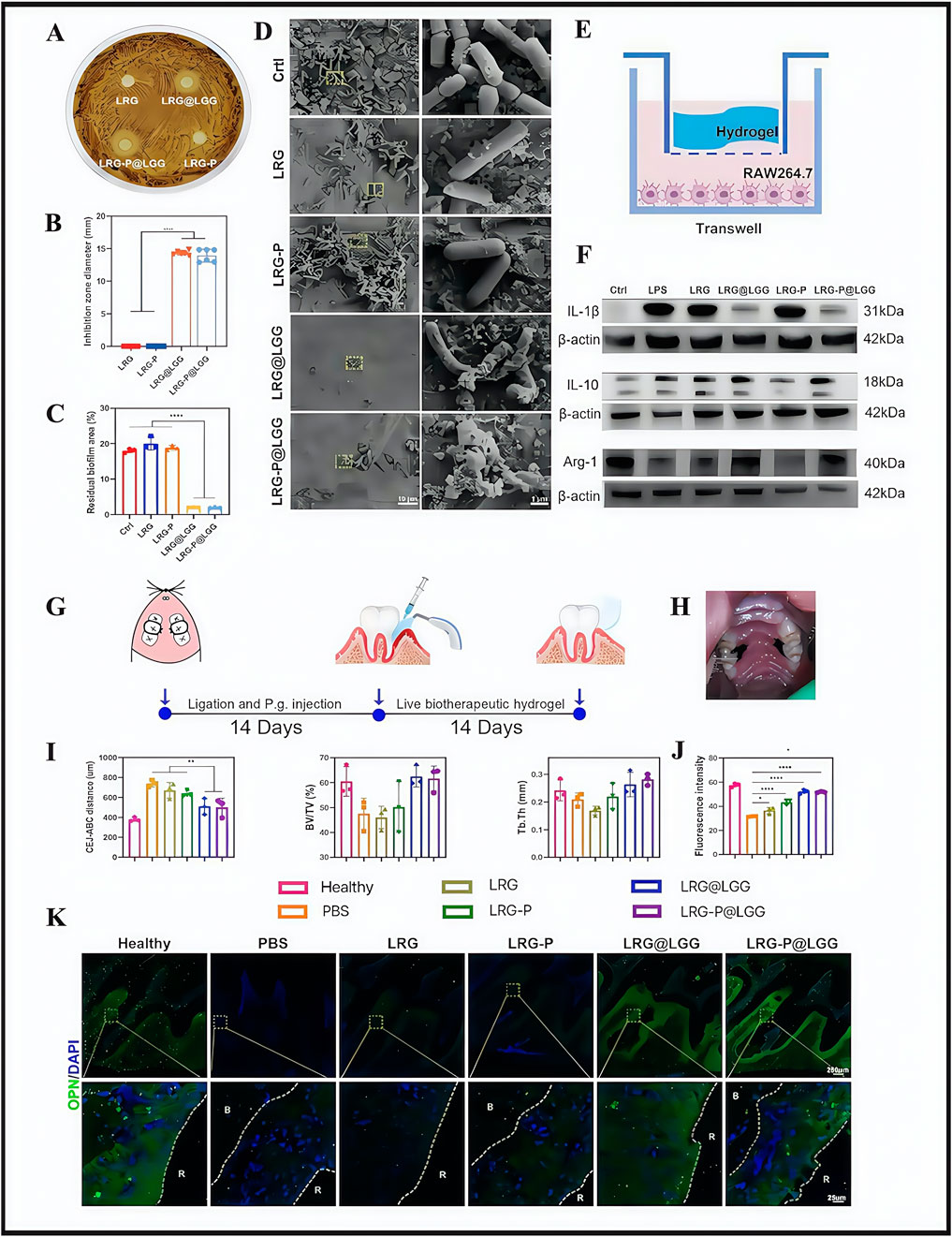 Multiple panels present an analysis of a hydrogels' effect on bacterial inhibition and immune responses. Panel A: Agar plate showing zones of inhibition around samples labeled LRG, LRG@LGG, LRG-P@LGG, and LRG-P.Panel B: Bar chart depicting inhibition zone diameters. Panel C: Bar chart showing residual biofilm areas. Panel D: Four rows of electron microscope images display bacterial growth in different treatments: Ctrl, LRG, LRG-P, LRG@LGG, and<a href=