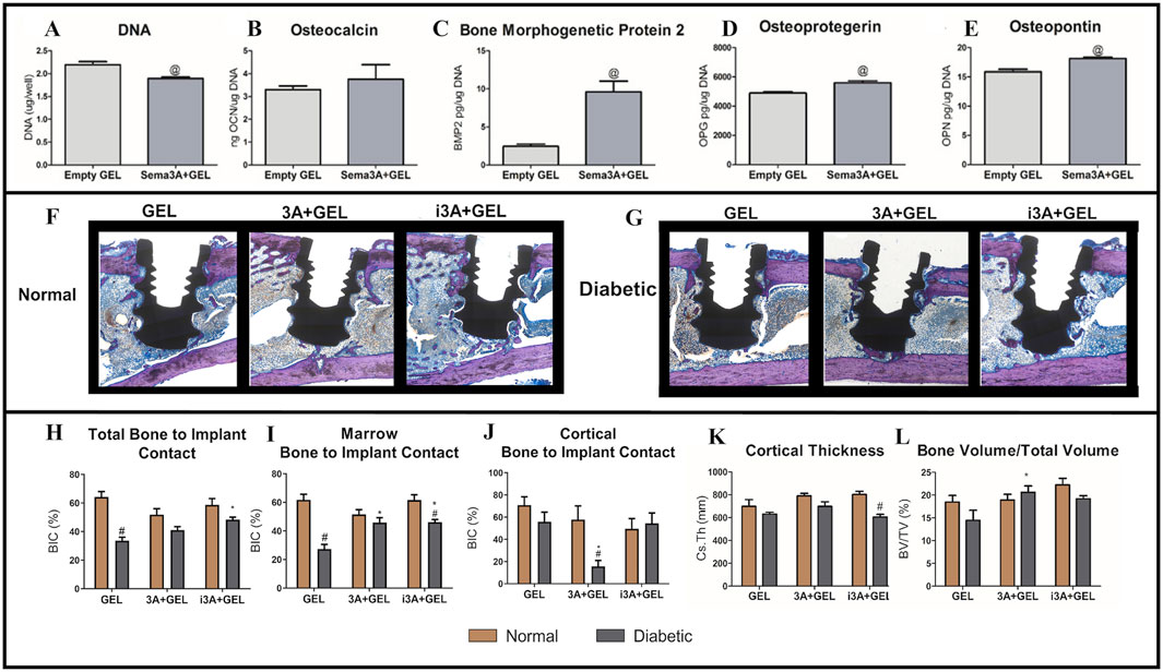 Graphs and histological images compare bone regeneration in normal and diabetic conditions using different gel treatments. Charts A to E show levels of DNA, osteocalcin, bone morphogenetic protein 2, osteoprotegerin, and osteopontin. Images F and G display histological sections with variations in bone growth. Graphs H to L depict metrics like total bone to implant contact, marrow contact, cortical contact, cortical thickness, and bone volume/total volume, with differences noted between normal and diabetic groups, and across gel treatments.