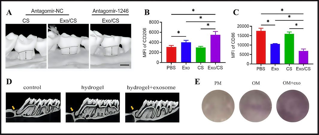 Panel A shows micro-CT images of mouse molars with labeled conditions: Antagomir-NC and Antagomir-1246 under CS and Exo/CS treatments. Panel B presents a bar graph illustrating the MFI of CD206 with significant differences marked by asterisks. Panel C is a bar graph showing the MFI of CD86, with similar significance markers. Panel D includes micro-CT images of dental structures under control, hydrogel, and hydrogel with exosome conditions, highlighted by arrows. Panel E displays three circular culture images labeled PM, OM, and OM+exo.