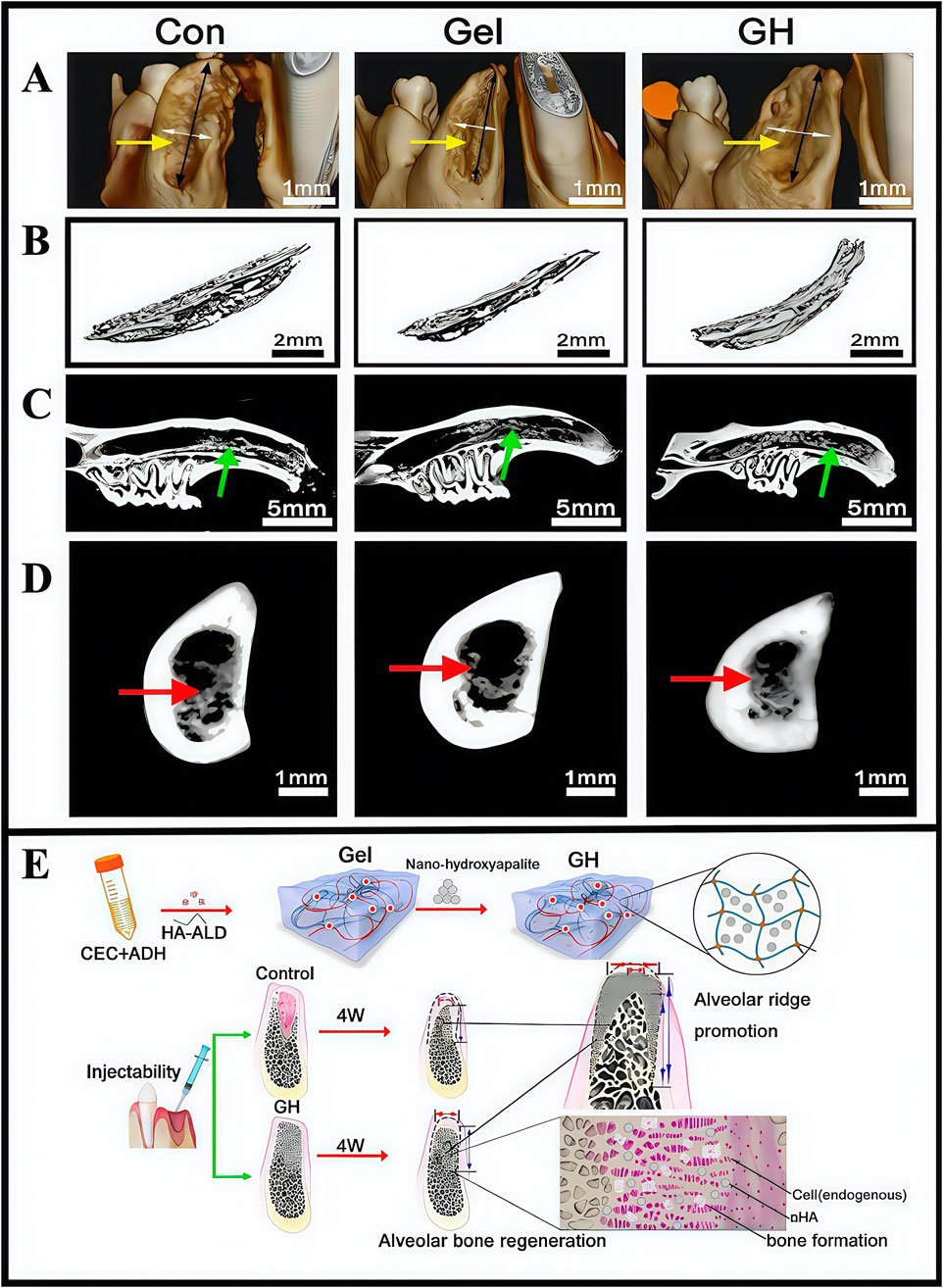 Composite image comparing bone regeneration across three conditions: Control (Con), Gel, and GH. Panels A to D depict 3D scans and cross-sections with yellow, green, and red arrows highlighting specific areas. Panel E illustrates a process using CEC, ADH, and HA-ALD to form Gel and GH, showing their injectability and effects on alveolar bone regeneration over four weeks, with diagrams of bone structure enhancement and microscopic details.