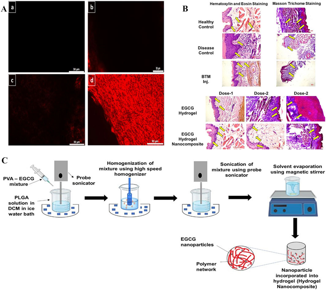 Figure A shows fluorescent micrographs labeled a to d, illustrating different samples with increasing intensity of red staining. Figure B presents histological images with Hematoxylin and Eosin, and Masson’s Trichrome staining, comparing healthy controls, disease controls, and different treatment groups with arrows indicating key areas. Figure C is a schematic of a preparation process involving PVA-EGCG mixture, PLGA solution, and homogenization steps, resulting in nanoparticles incorporated into a hydrogel nanocomposite.