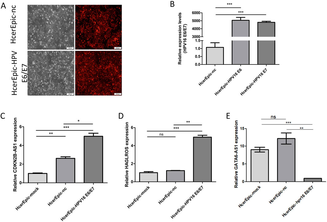 A five-panel figure shows cellular and molecular data. Panel A displays microscope images of HcerEpic-nc and HcerEpic-HPV E6/E7 cells, indicating cell density and fluorescent staining. Panel B is a bar graph showing relative expression levels of HPV16 E6 and E7, with significant differences marked by asterisks. Panels C, D, and E are bar graphs depicting relative expression of CDKN2B-AS1, HAGLROS, and GATA6-AS1, respectively, in different conditions, with significance denoted by asterisks and ns for not significant.