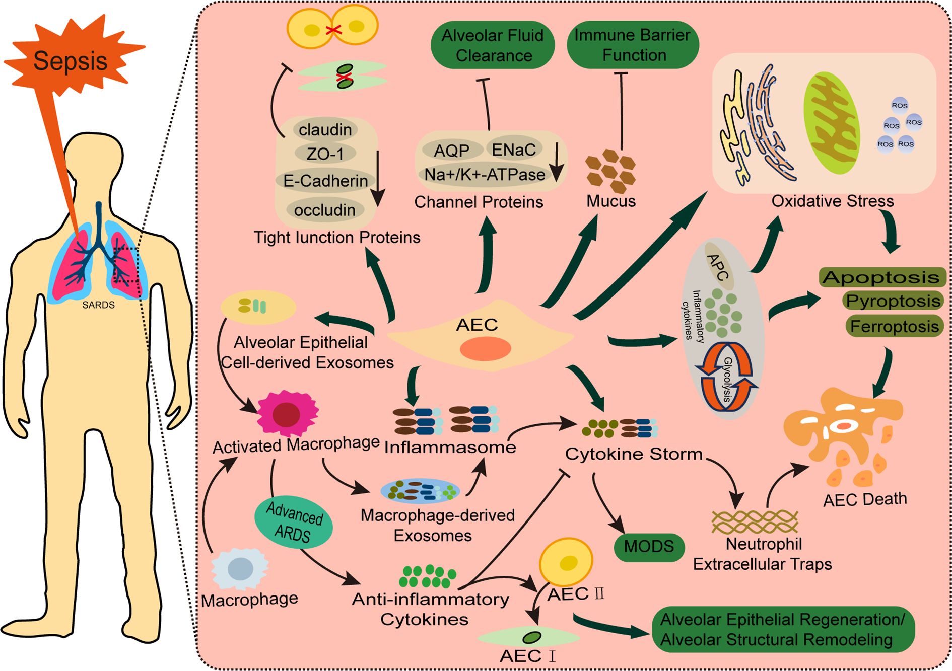 Diagram illustrating the process of sepsis affecting alveolar cells and immune responses. It shows pathways like alveolar fluid clearance, immune barrier function, and inflammasome activation. Elements include tight junction proteins, macrophages, cytokine storms, oxidative stress, apoptosis, and pathways like alveolar epithelial regeneration. Pathogens like Staphylococcus aureus play a role, leading to conditions like sepsis-associated acute lung injury.