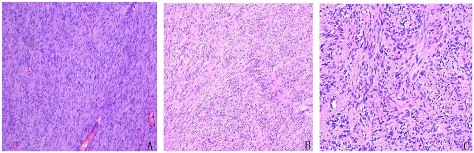 Histological images showing tissue samples with cellular structures stained in purple and pink hues. Panel A displays densely packed cells, panel B shows a medium density, and panel C presents loosely arranged cells with visible nuclei.