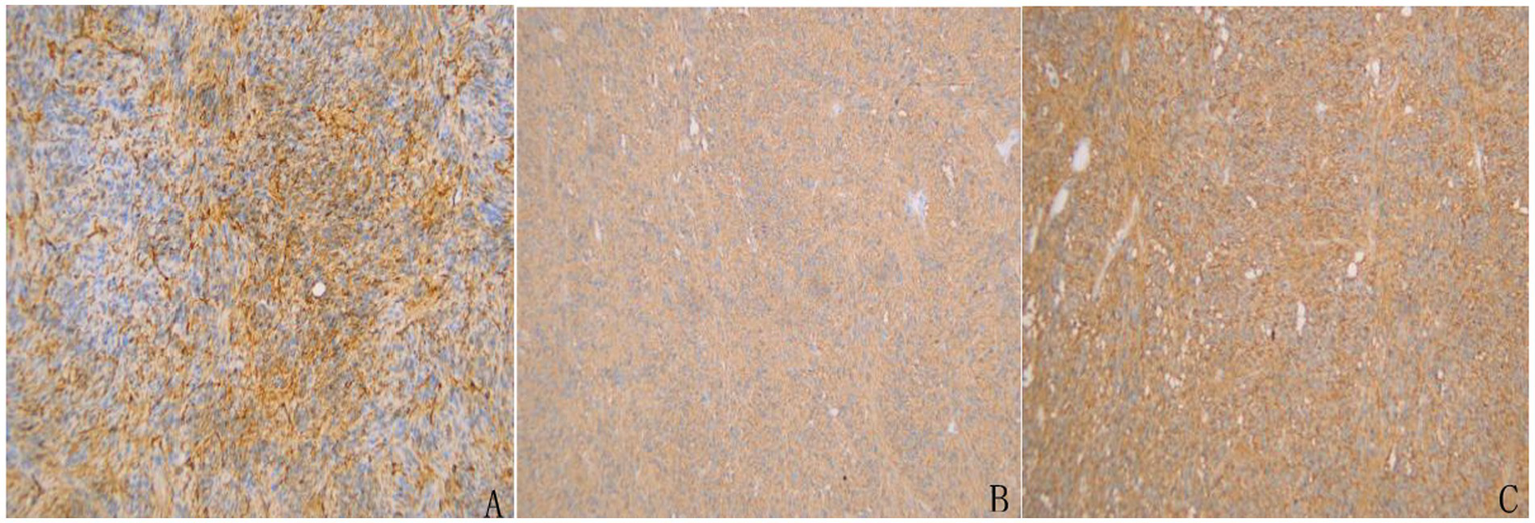 Three panels labeled A, B, and C display microscopic views of tissue samples with different staining intensities. Panel A shows a dense, darker staining with visible texture. Panel B displays a lighter and more uniform staining pattern. Panel C has moderate staining intensity with a mix of darker and lighter areas.