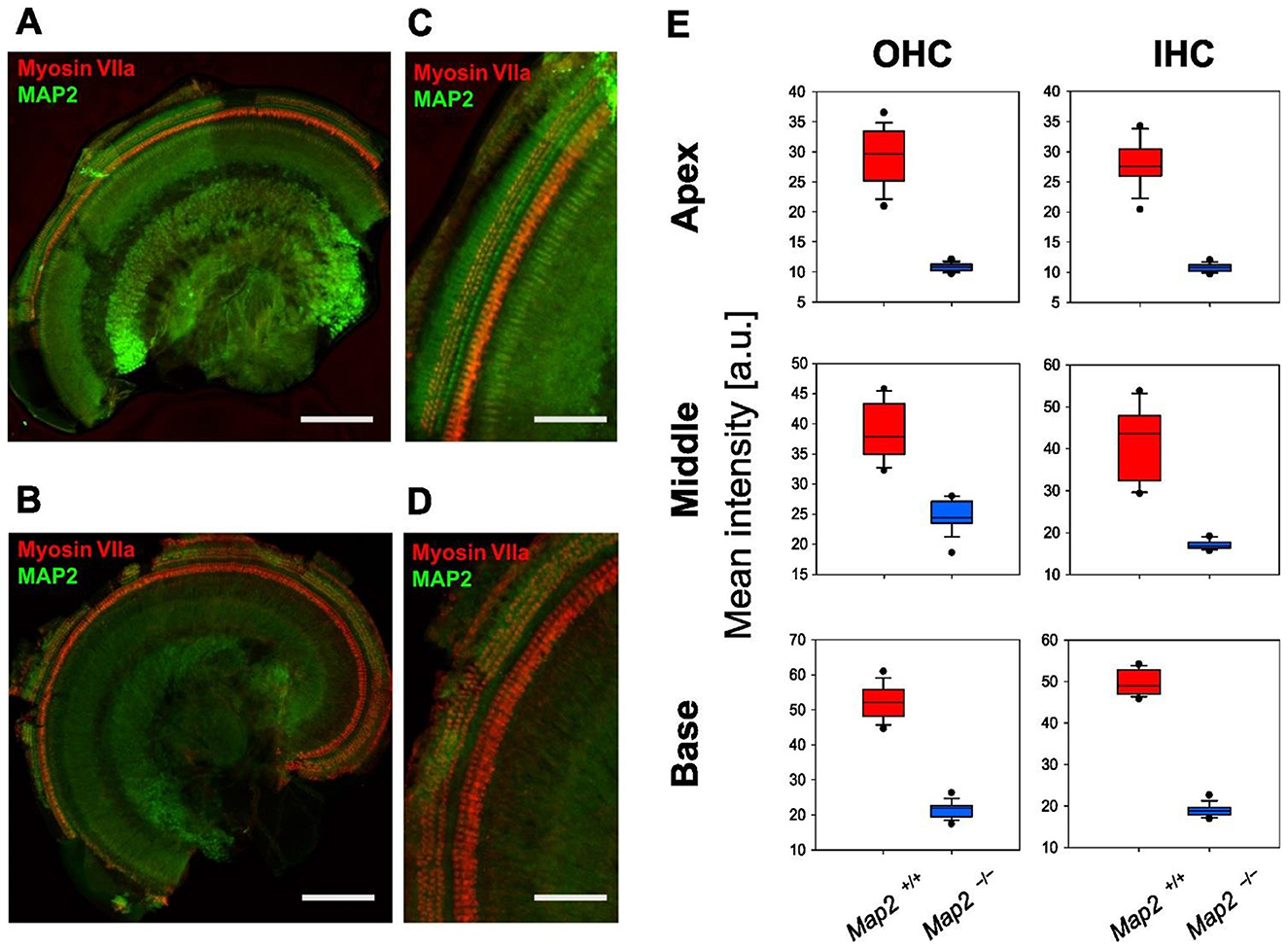 Confocal microscopy images and box plots. Panels A and B show cochlear cross-sections labeled with Myosin VIIa MYO7A (red) and MAP2 (green), demonstrating structural differences. Panels C and D provide magnified views of the cochlear hair cell regions. Panel E consists of box plots showing mean intensity levels for outer hair cells (OHC) and inner hair cells (IHC) at apex, middle, and base regions, comparing different genetic conditions.