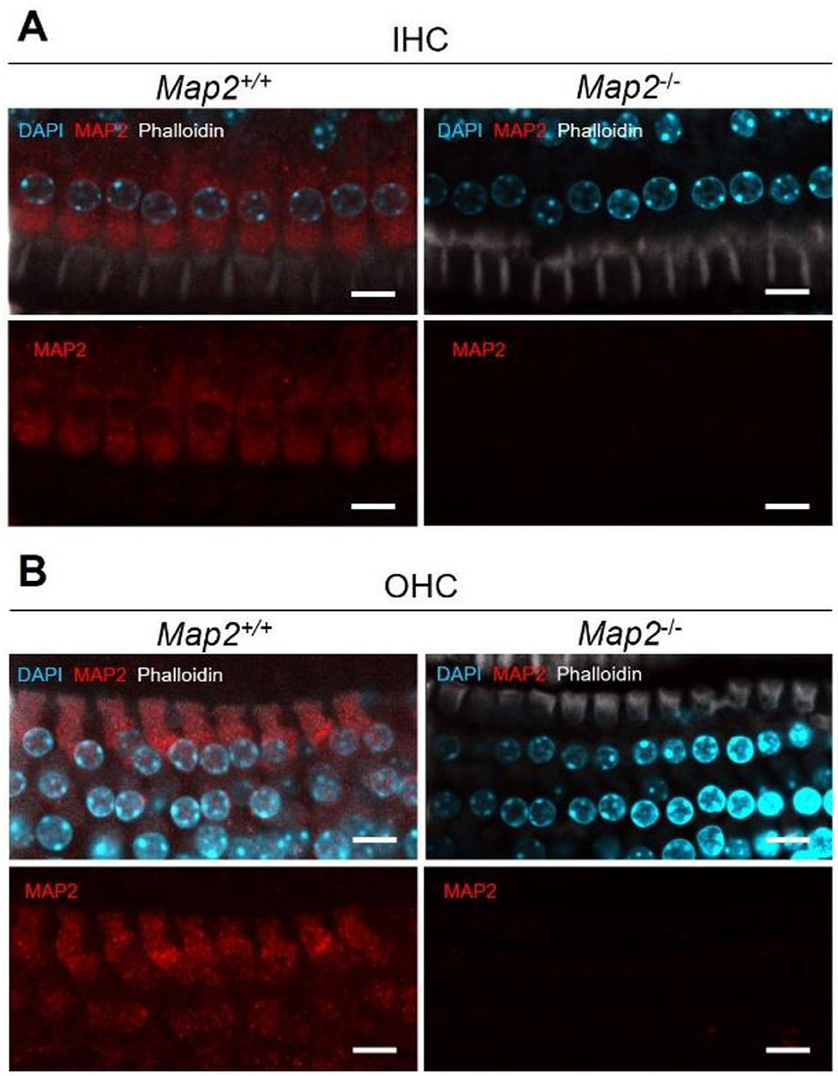 Fluorescent microscopy images showing the expression of MAP2, DAPI, and Phalloidin in inner hair cells (IHC) and outer hair cells (OHC) for Map2 wild type (Map2+/+) and knockout (Map2-/-) mice. In Map2+/+ IHC and OHC, red MAP2 staining is prominent, while it is absent in Map2-/- samples. DAPI stains nuclei in blue, and Phalloidin labels actin in white. Scale bars are present for reference.