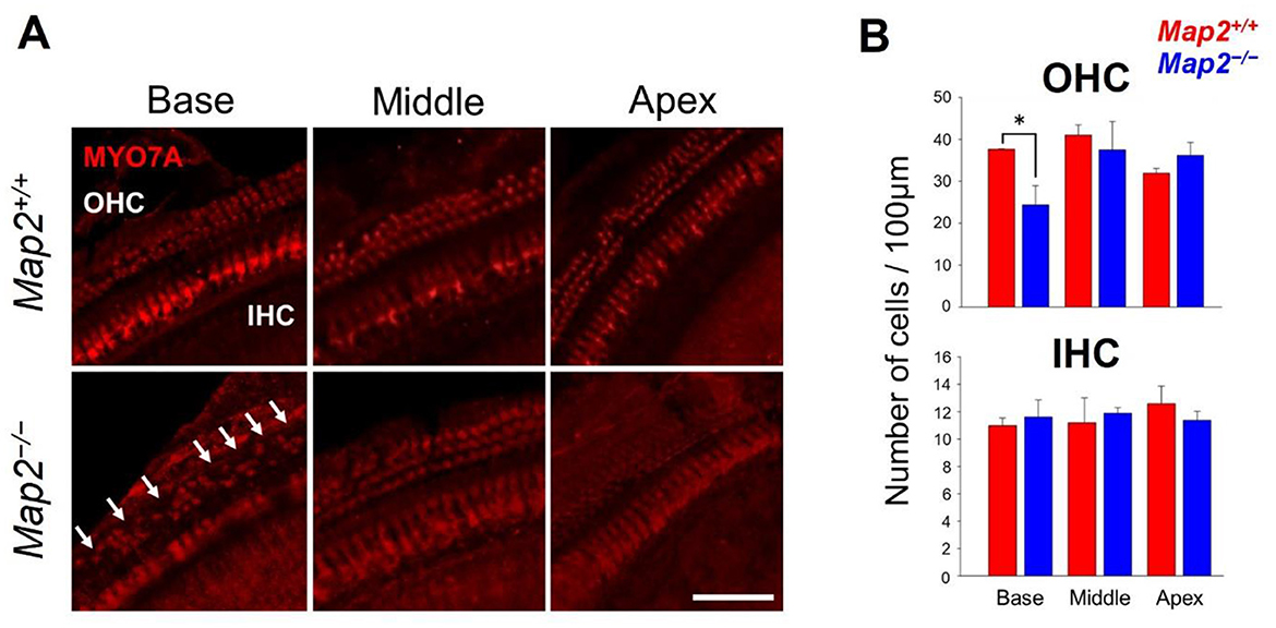 Panel A shows fluorescent microscopy images of cochlear hair cells labeled with MYO7A in Map2+/+ and Map2-/- mice across base, middle, and apex regions. The Map2-/- image at the base shows disrupted outer hair cells (OHC) with arrow indicators. Inner hair cells (IHC) are also visible. Panel B presents bar graphs showing outer and inner hair cell counts per 100 micrometers for both genotypes, with a significant difference marked by an asterisk for OHC at the base. Red bars represent Map2+/+ and blue bars represent Map2-/-.