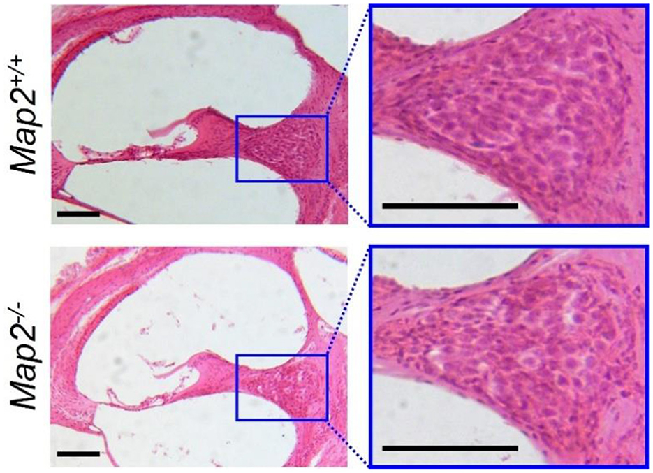 Histological images showing a comparison between Map2+/+ and Map2-/- samples. The left panels display low magnification views with highlighted regions that are magnified on the right. The Map2+/+ sample shows comparable cellular structures and density to those of the Map2-/- sample. Both images are stained, displaying cellular details in pink with scale bars included.