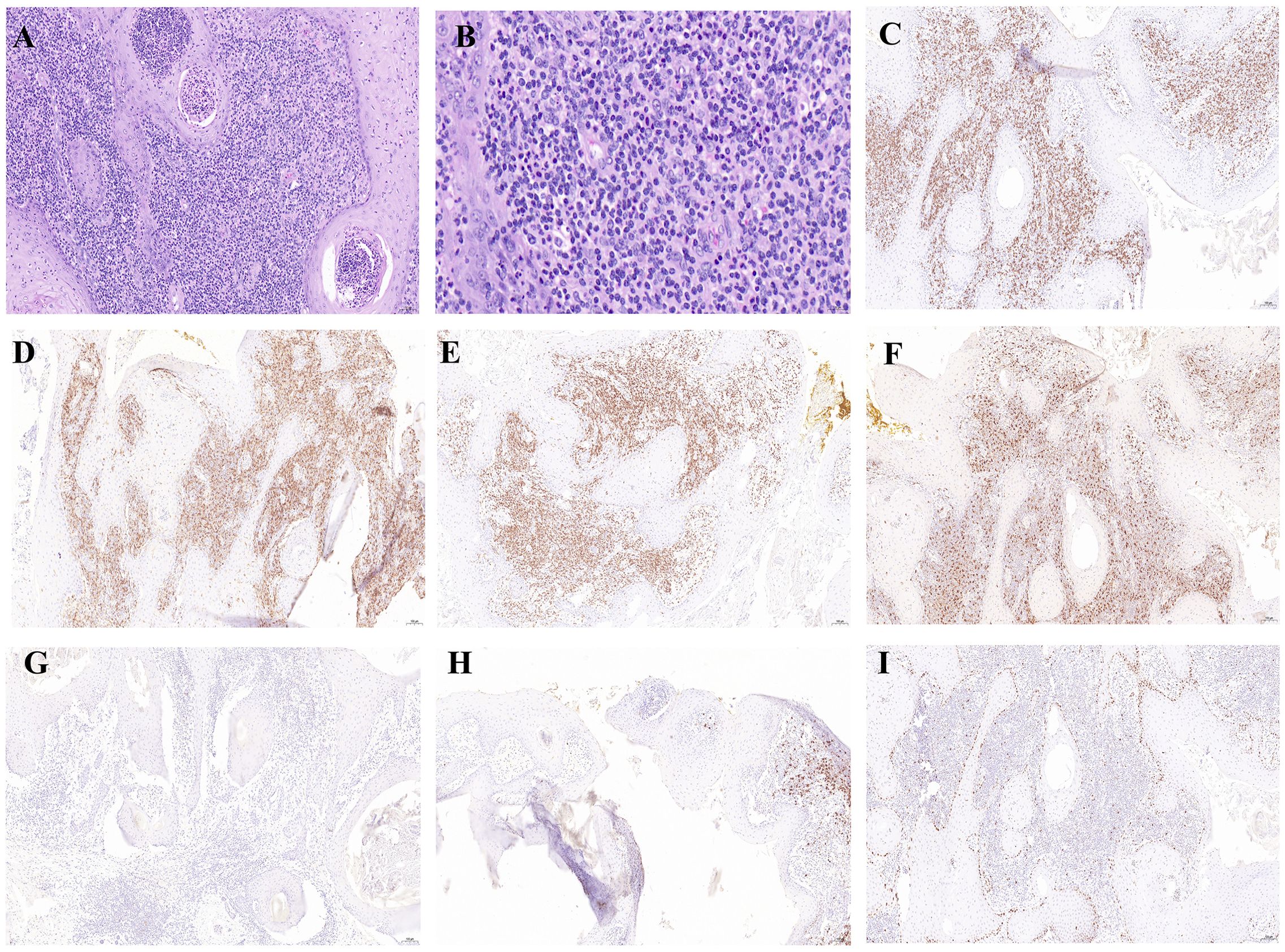 Histological image set shows various tissue samples. Panels A and B depict close-up views of cells stained for detail. Panels C to I display larger sections with different staining intensities, highlighting tissue structures and cell distribution. Each panel presents a unique pattern of cell density and chromatic variation, indicating different histological features.