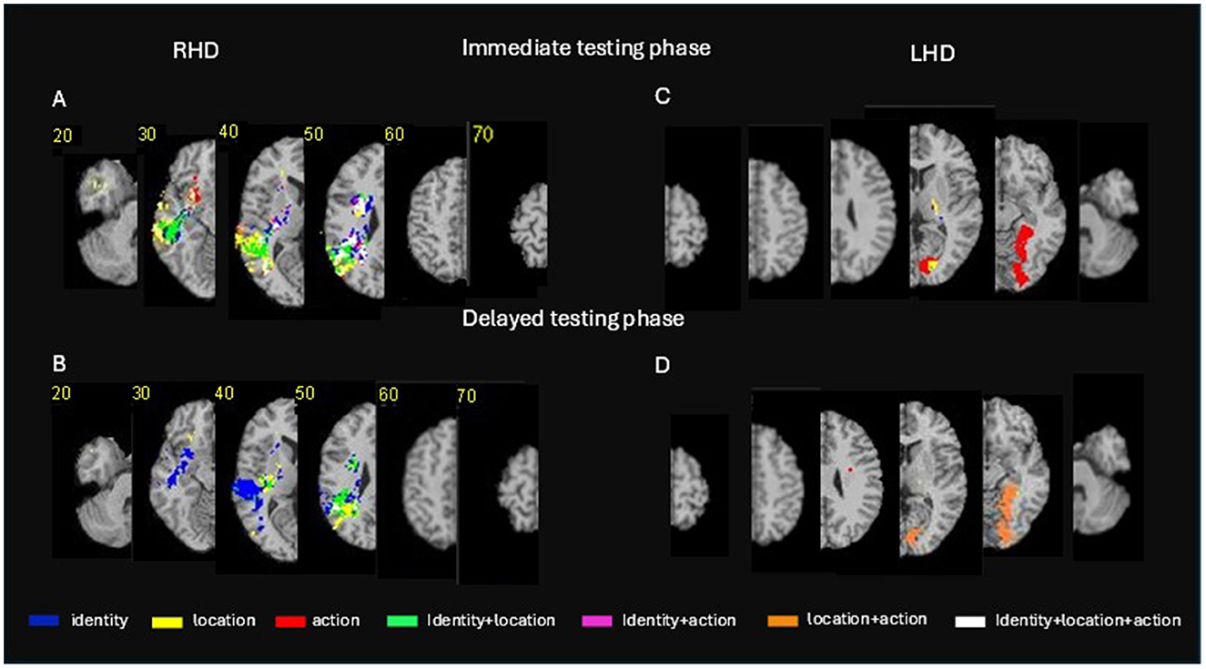 Conjunction VLSM maps showing brain regions where damage significantly affected identity, location, and action memory during immediate and delayed testing phases. Panels A and B represent RHD results for immediate and delayed phases; panels C and D show LHD results. Color-coded voxels indicate significant effects (z>2.6, p < 0.005) overlaid on MNI template brains. Slice numbers indicate brain levels, and displays follow radiological convention (right hemisphere on the left).