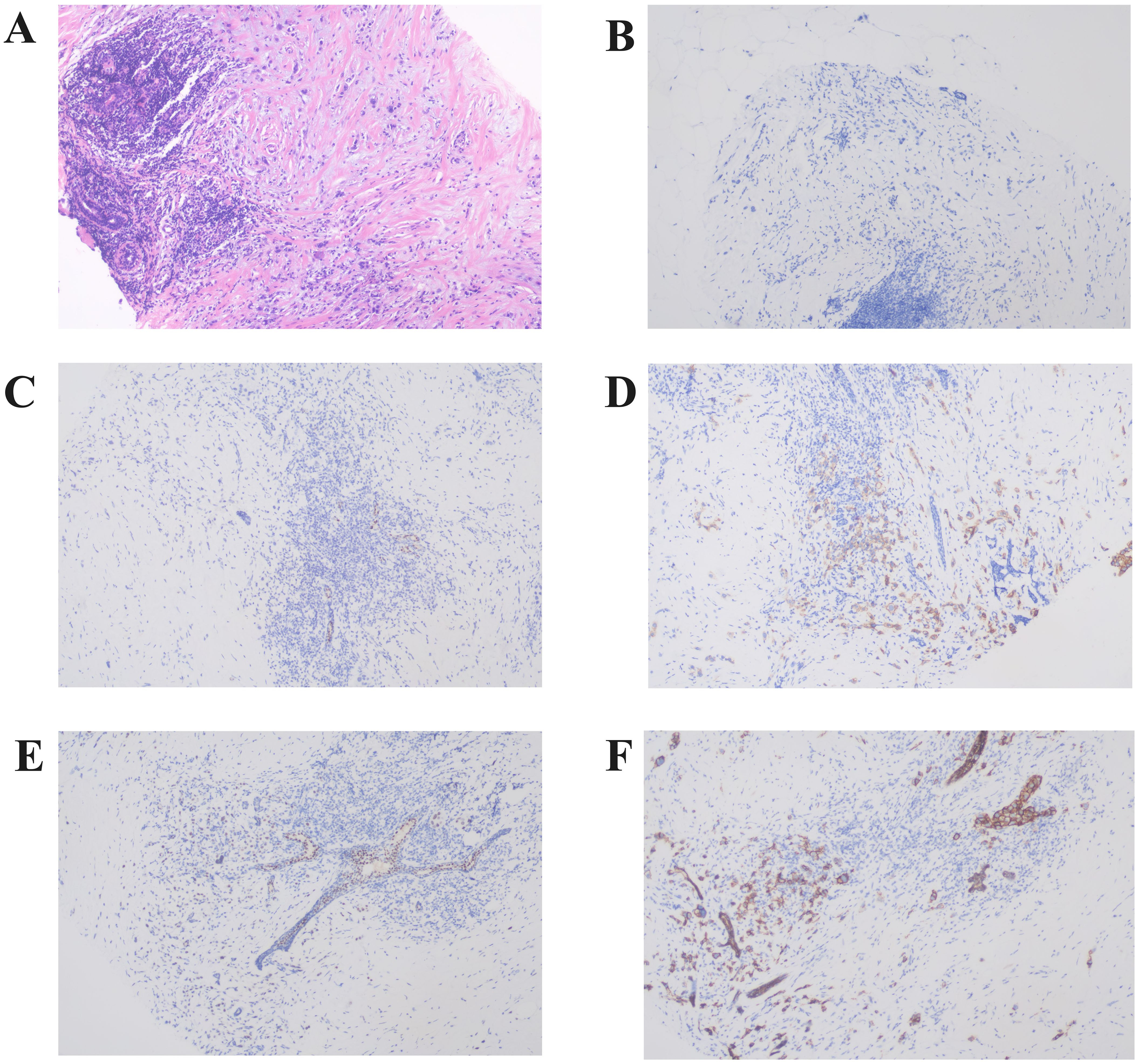 Histological images show different panels labeled A to F. Panel A displays a section with vivid purples and pinks, indicating tissue details. Panels B to F reveal varying intensity of blue staining, with D, E, and F also featuring brownish areas, suggesting different cellular markers or structures.