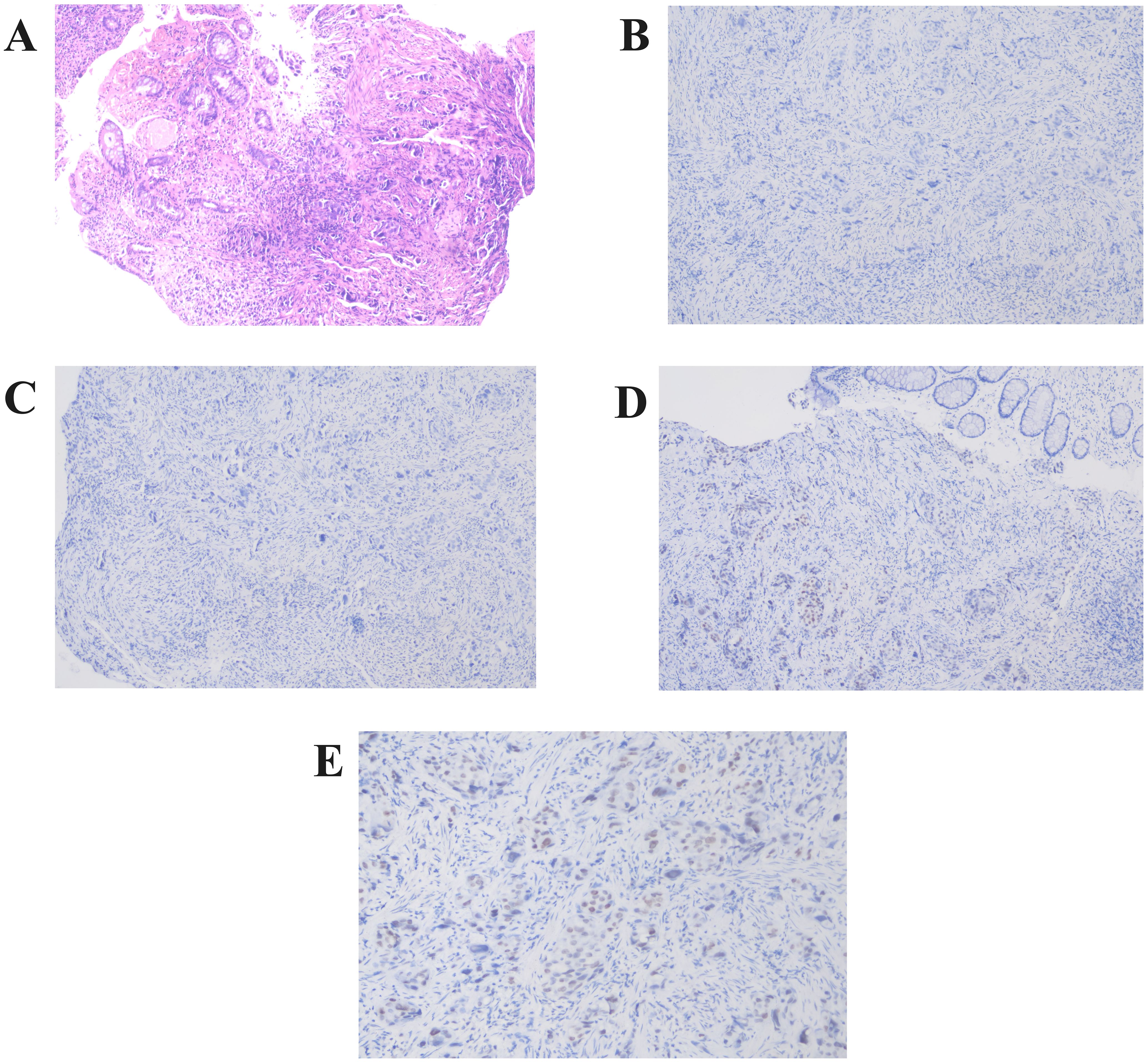 Histological analysis showing five panels labeled A to E. Panel A displays a tissue section with dense cellular structures stained in pink and purple, indicating a typical histological stain like H&E. Panels B to E show similar tissue sections with lighter blue staining, suggesting different staining techniques or markers, resulting in less prominent cellular detail. Each panel presents varying tissue patterns and staining intensities.