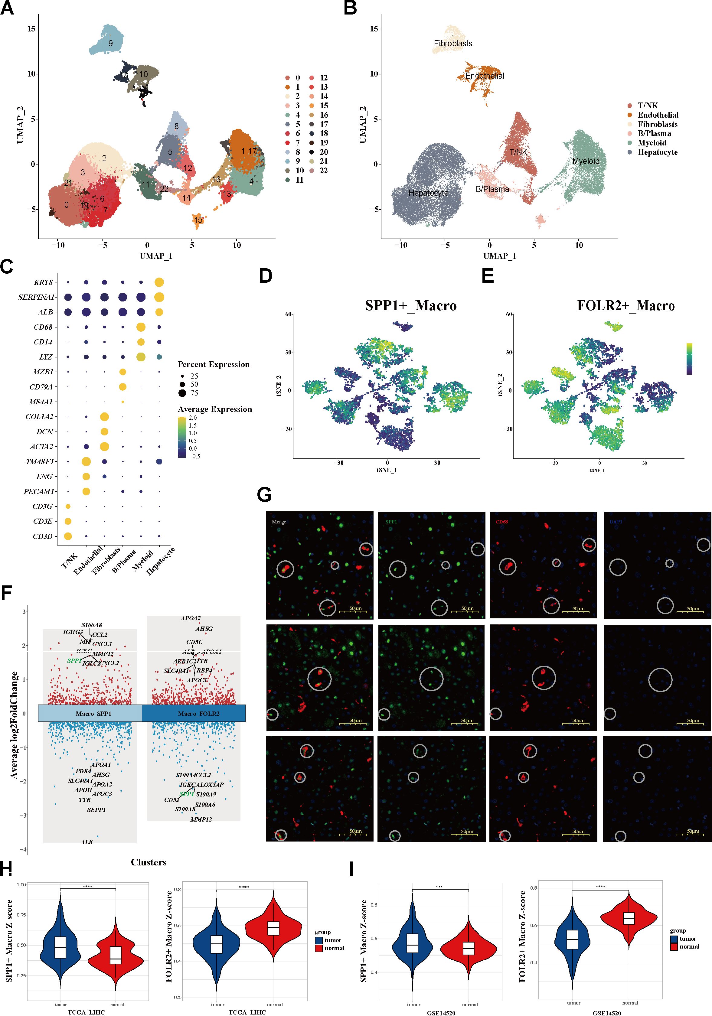 The image comprises various panels illustrating single-cell RNA sequencing data from liver samples. A and B show UMAP plots with clusters labeled and colored according to cell types. C is a dot plot displaying gene expression profiles across cell types. D and E show t-SNE plots for specific macrophage subtypes, SPP1+_Macro and FOLR2+_Macro. F includes volcano plots highlighting differential gene expression between macrophage subsets. G consists of immunofluorescence images of liver tissue highlighting macrophage markers. H and I present violin plots comparing expression levels of macrophage types between tumor and normal samples in different datasets.