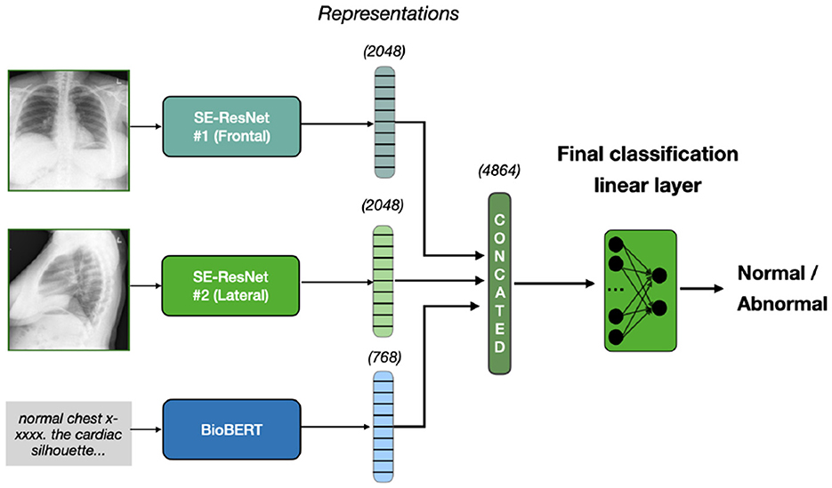 Diagram showing a system for classifying chest X-rays. Two X-rays, frontal and lateral, are inputted into SE-ResNet models, producing representations of 2048 dimensions each. Text data is processed by BioBERT, producing a 768-dimension representation. These are concatenated to form a 4864-dimension vector, which a linear layer classifies as normal or abnormal.