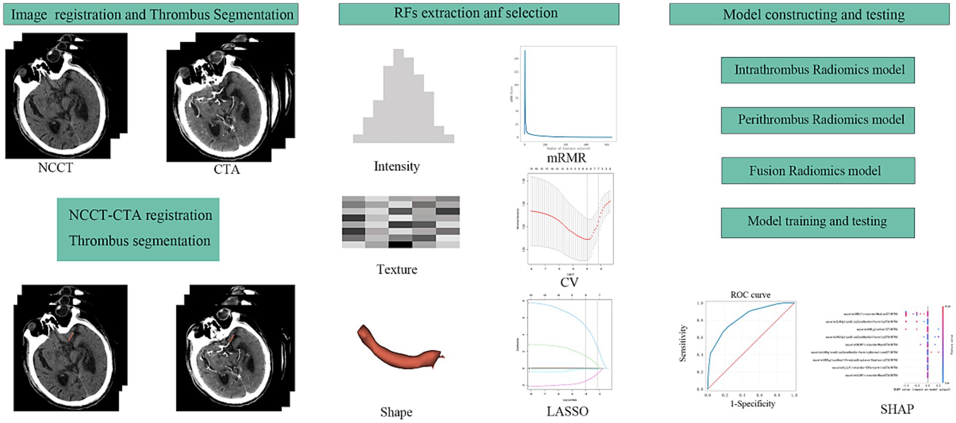 Diagram illustrating a workflow for radiomics analysis. It includes three main sections: Image Registration and Thrombus Segmentation with NCCT and CTA scans; RFs Extraction and Selection showing intensity, texture, shape, and various graphs; and Model Constructing and Testing featuring intrathrombus, perithrombus, and fusion radiomics models, along with training and testing, an ROC curve, and SHAP analysis.