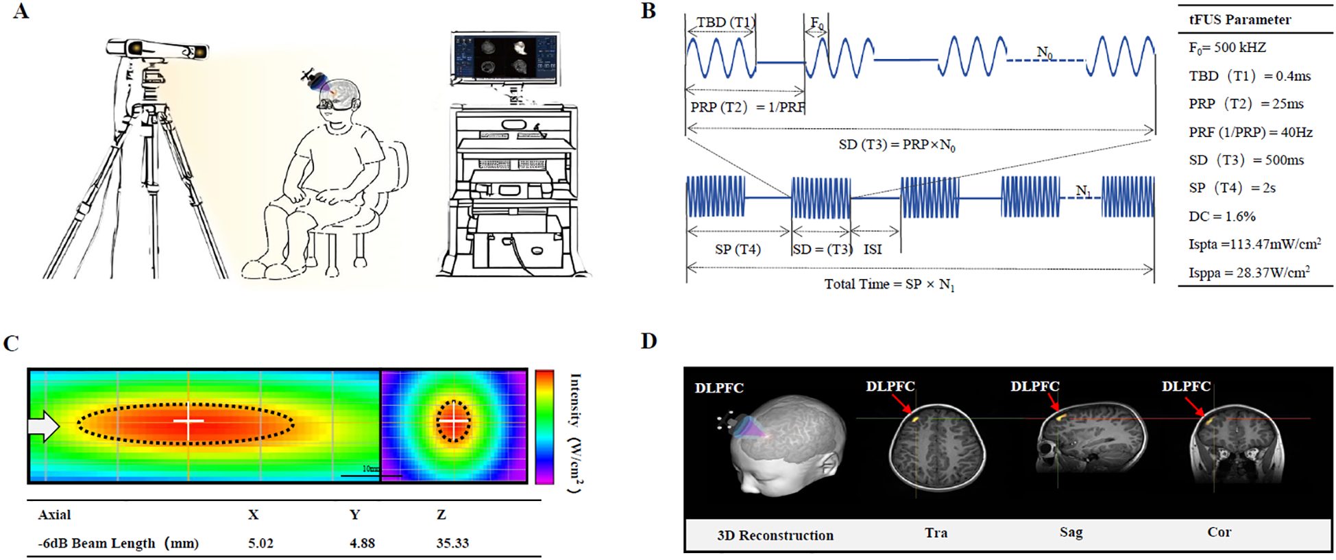 Diagram with four panels illustrating transcranial focused ultrasound stimulation (tFUS) setup and effects. Panel A: Setup with equipment targeting a subject's head. Panel B: Waveform with parameters including frequency and time intervals. Panel C: Beam intensity distribution showing -6dB beam length in millimeters. Panel D: Brain imaging, highlighting the dorsolateral prefrontal cortex (DLPFC) with 3D reconstruction and MRI slices.
