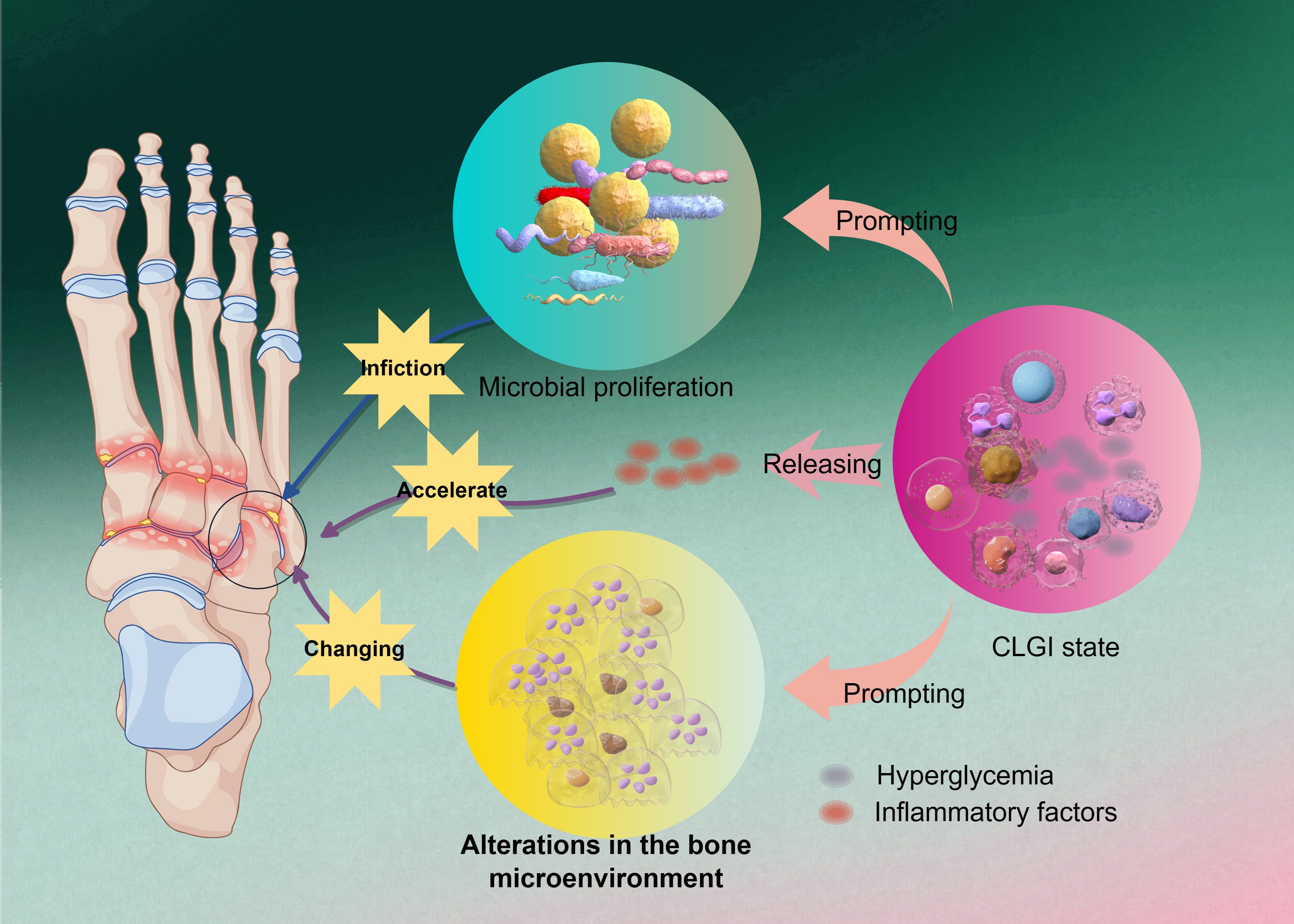 Illustration depicting the progression of a foot infection. A skeletal foot shows inflamed joints with labels for microbial proliferation, alterations in the bone microenvironment, and CLGI state. Arrows indicate the processes of “infliction,” “accelerate,” “changing,” “prompting,” and “releasing,” alongside visuals of microbes, cells, and factors related to hyperglycemia and inflammation.