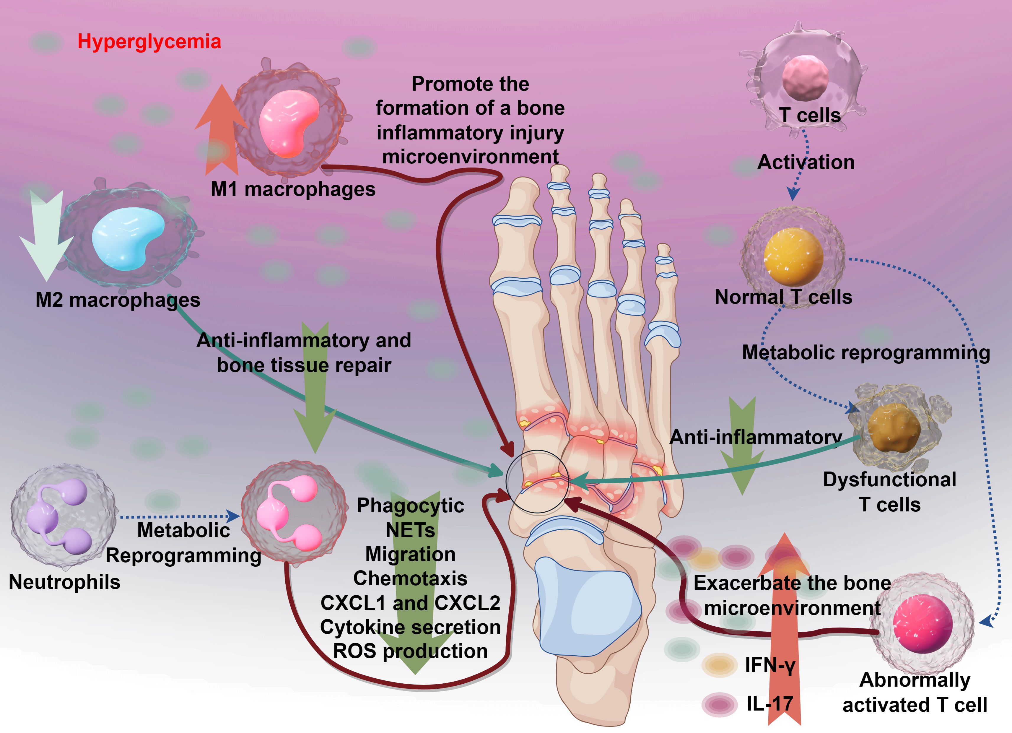 Diagram showing the impact of hyperglycemia on bone inflammation. M1 macrophages promote inflammatory environments, while M2 macrophages reduce inflammation and aid tissue repair. Neutrophils undergo metabolic reprogramming, leading to cytokine secretion. Normal T cells become dysfunctional through activation and metabolic reprogramming, worsening the bone microenvironment. The diagram centers on a foot illustration, highlighting joint inflammation.