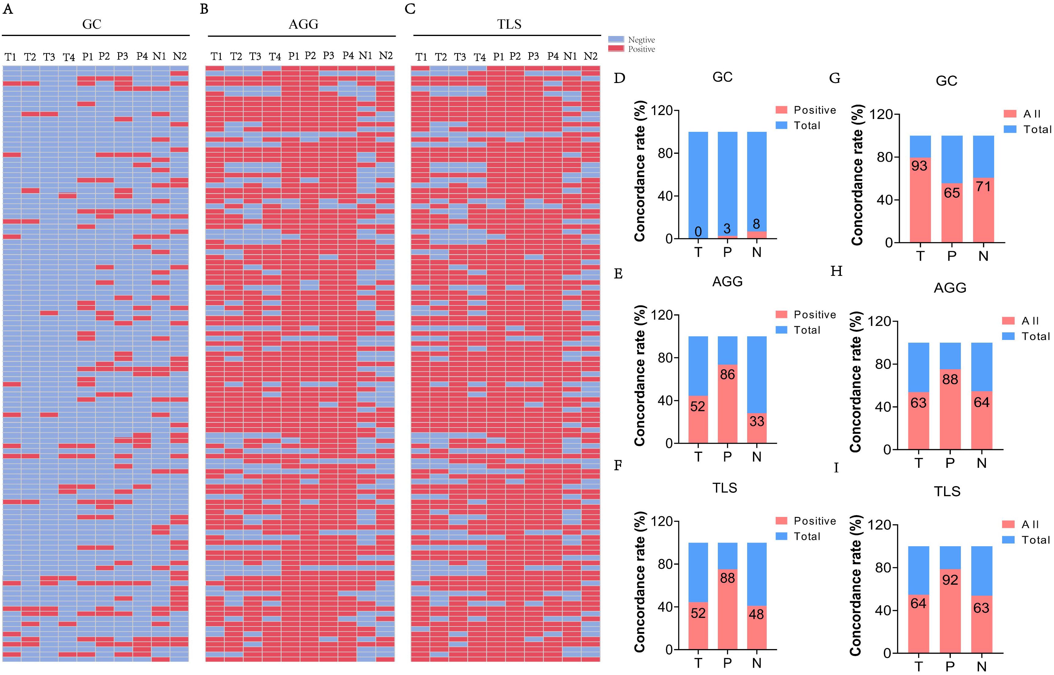 Heat maps and bar charts illustrate concordance rates for GC, AGG, and TLS across different sample types (T, P, N). The heat maps (A, B, C) use color coding for negative (blue) and positive (red) results. The bar charts (D-I) display concordance rates in percentages, showing positive and total rates for each sample type, with distinct data for GC, AGG, and TLS. Different bar sections represent total observations and classifications.