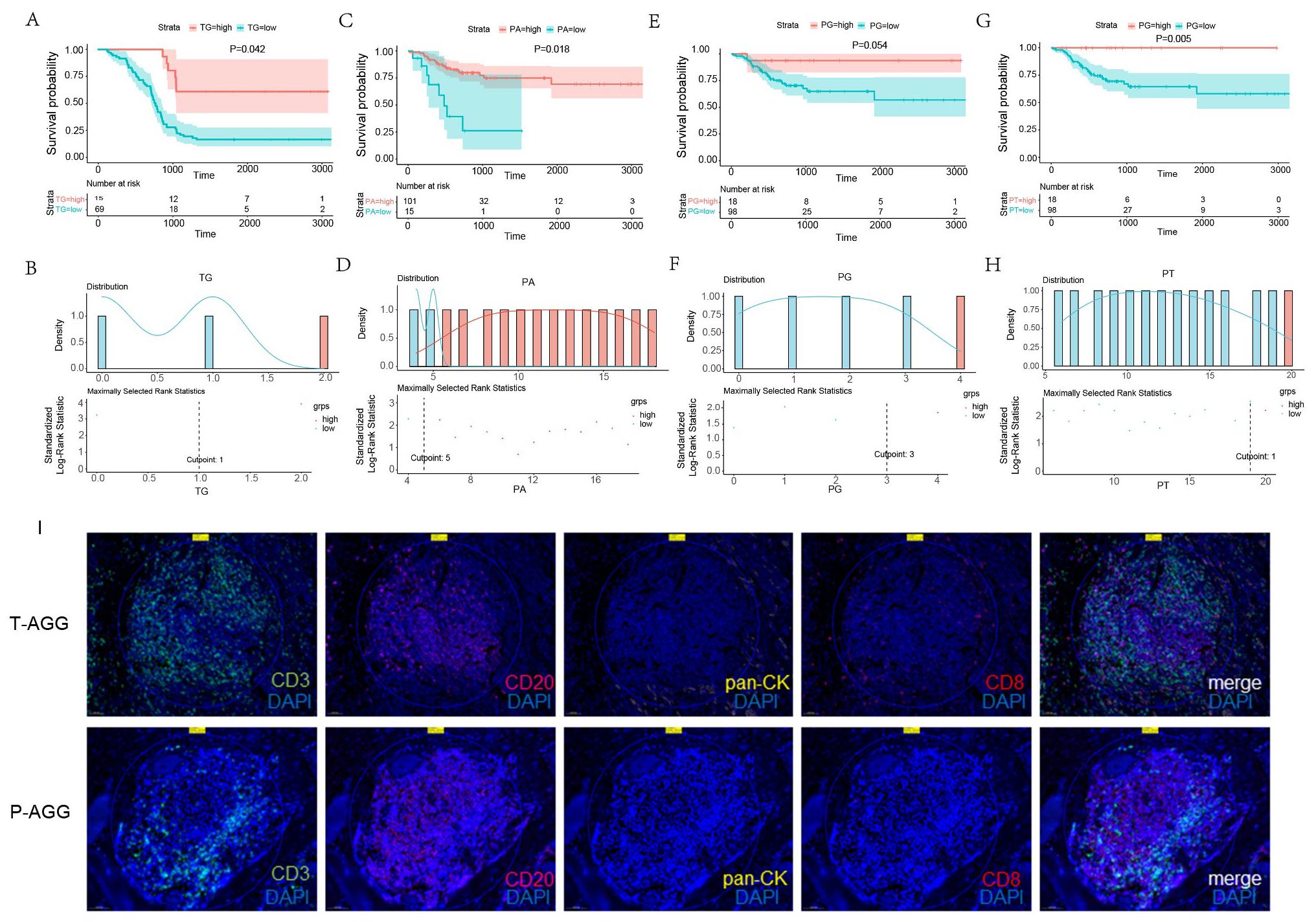 The image consists of multiple panels showing survival probability graphs and tissue fluorescence microscopy images. Panels A, C, E, and G display Kaplan-Meier survival curves comparing high and low strata for TG, PA, and PG markers, indicating significant differences in survival times. Panels B, D, F, and H illustrate statistical distributions with cutpoints for TG, PA, PG, and PT markers. Section I presents fluorescence images of tissues stained with CD3, CD20, pan-CK, and CD8, shown in different colors, depicting lymphoid aggregates in T-AGG and P-AGG groups. The bottom row shows merged fluorescence images combining these markers.