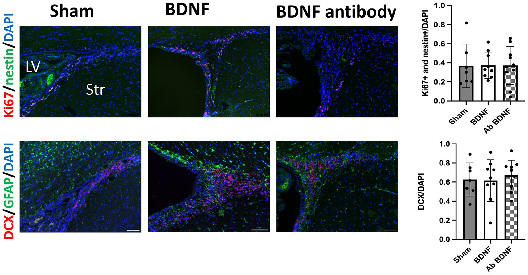 Fluorescent microscopy images show brain tissue stained with Ki67/nestin/DAPI and DCX/GFAP/DAPI across three conditions: Sham, BDNF, and BDNF antibody. Color-coded sections highlight different proteins. Adjacent bar graphs display quantitative analyses of Ki67 and nestin, and DCX expression, with error bars indicating variability. Labels indicate brain regions: LV (lateral ventricle), Str (striatum).