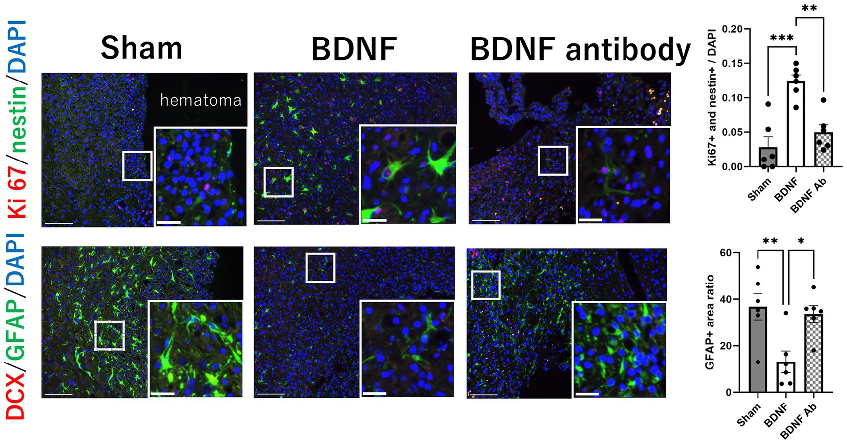 Fluorescent microscopy images and graphs show the expression of Ki67/nestin and DCX/GFAP in Sham, BDNF, and BDNF antibody treated samples. Insets highlight cellular details. Graphs depict significant differences in Ki67 and nestin positive cells and GFAP area ratios among the groups, with statistical significance indicated by asterisks.