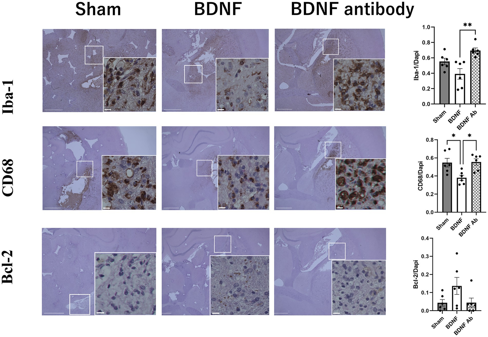 Histological images and corresponding bar graphs depict the expression of Iba-1, CD68, and Bcl-2 in brain tissue under three conditions: Sham, BDNF, and BDNF antibody. Insets show magnified views. The bar graphs on the right illustrate increased Iba-1 and CD68 expression with BDNF antibody treatment, while Bcl-2 shows minimal change. Statistical significance is indicated with asterisks.