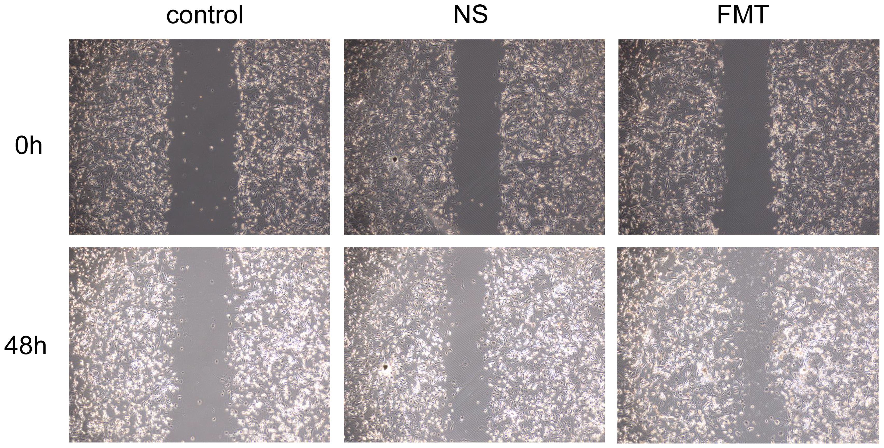 Microscopic images showing cell migration in a wound healing assay at time points zero hours and forty-eight hours. Columns are labeled control, NS, and FMT. The gap between cell fronts is initially wide and decreases over time, indicating cell movement.