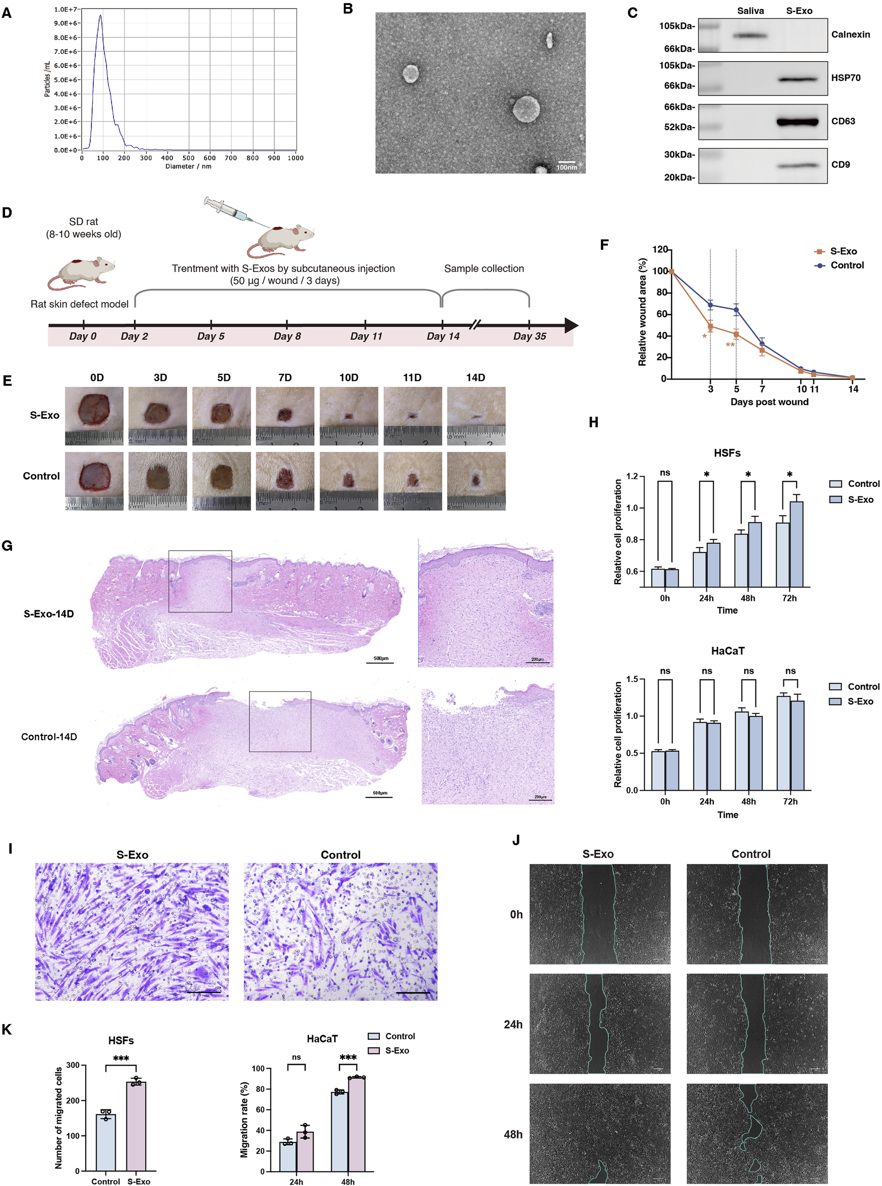 A composite image displays various scientific experiments and results. A) Line graph showing particle size distribution. B) Electron microscopy image of particles. C) Western blot analysis contrasting protein expression in saliva and S-Exo. D) Timeline illustrating treatment procedure through subcutaneous injection in a rat skin defect model. E) Sequential images of wound healing over fourteen days comparing S-Exo and control. F) Line graph showing wound area reduction over time with S-Exo versus control. G) Histological sections comparing skin tissue from S-Exo and control on the fourteenth day. H) Bar graphs of cell proliferation in HSFs and HaCaT cells over 72 hours, comparing S-Exo and control. I) Micrographs showing cell migration in S-Exo versus control. J) Time-lapse images of cell migration at zero, twenty-four, and forty-eight hours comparing S-Exo and control. K) Bar graphs quantifying cell migration and migration rate.