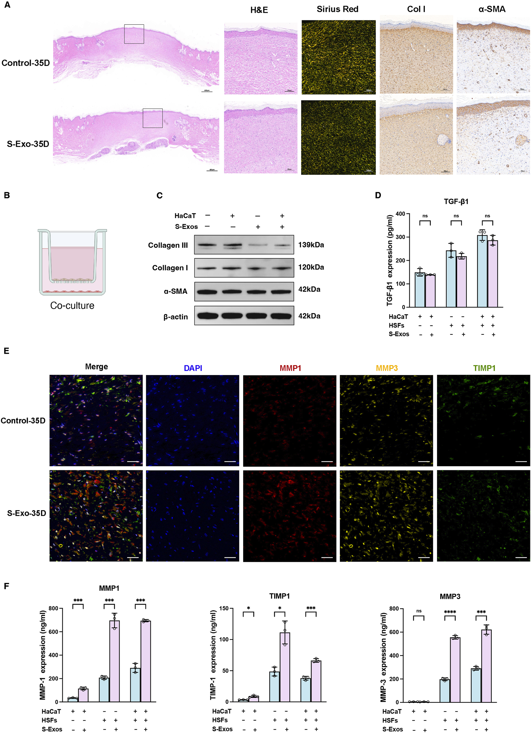 Panel A shows histological sections with H&E and Sirius Red staining, and immunohistochemistry for Collagen I and α-SMA, comparing Control-35D and S-Exo-35D. Panel B illustrates a co-culture setup. Panel C features a Western blot analysis for Collagen III, Collagen I, α-SMA, and β-actin. Panel D presents a bar graph of TGF-β1 expression with varying treatments. Panel E displays immunofluorescent staining of tissues showing DAPI, MMP1, MMP3, and TIMP1 under Control-35D and S-Exo-35D. Panel F consists of bar graphs for MMP1, TIMP1, and MMP3 expression among different treatment groups.