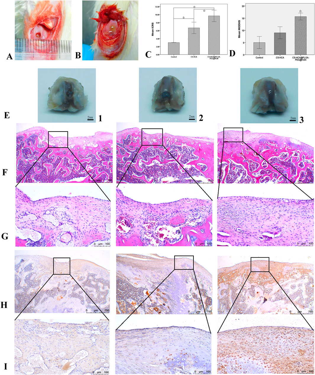 A series of images and graphs demonstrating a scientific study on tissue samples. Image A and B depict close-up photographs of surgical wounds on a subject, showing different stages of healing with visible stitches and measurements. Graphs C and D present bar charts comparing mean CES and MWS values for control and experimental groups, highlighting significant differences. Images E1, E2, and E3 show cross-sections of tissue samples with scale bars indicating size.Panels F, G, H, and I present microscopic images of histological sections, stained to show tissue structure and cellular detail, with scale bars for reference.